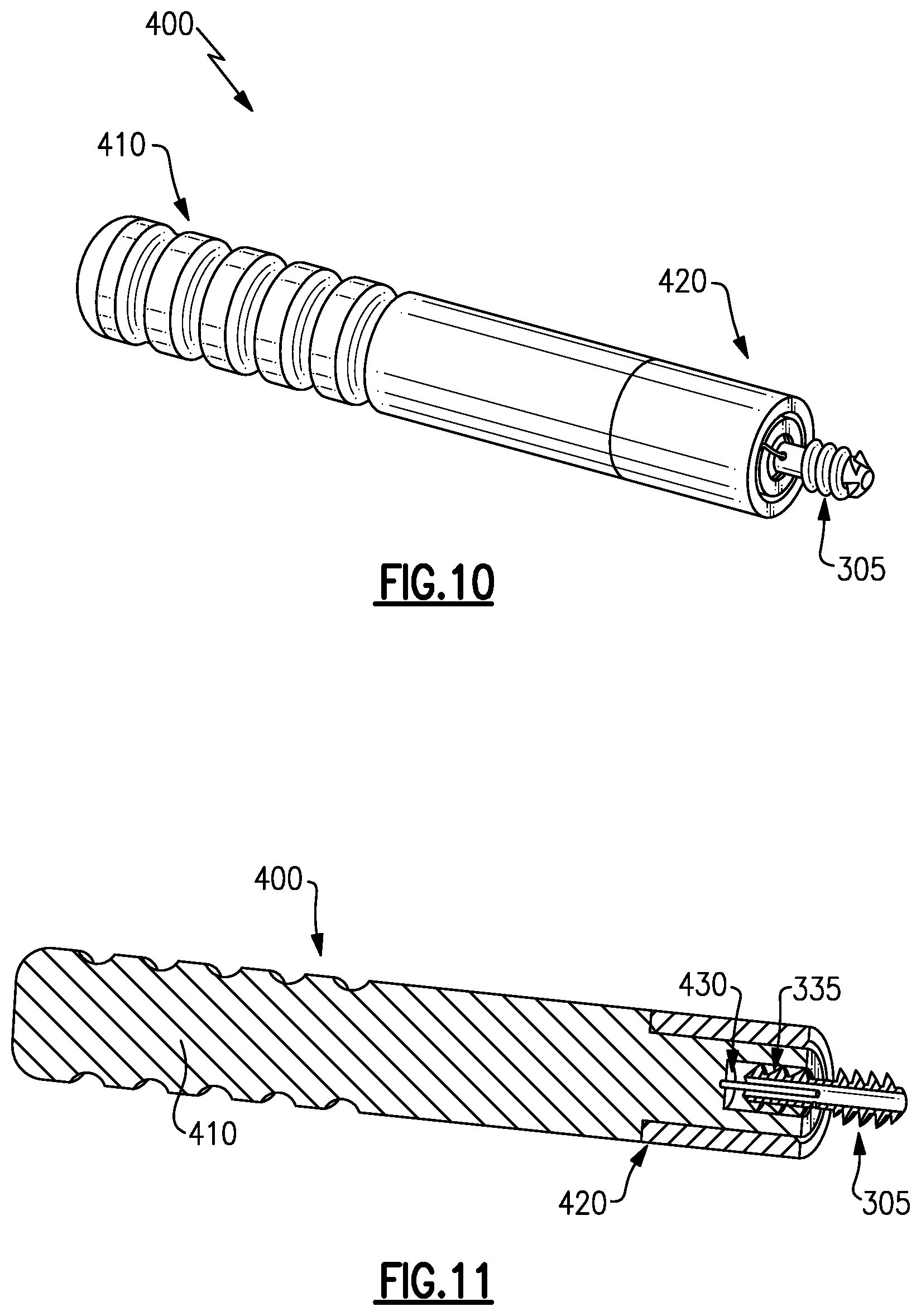 Patent US12496105 Figure 10 – Devices for generating and applying compression within a body