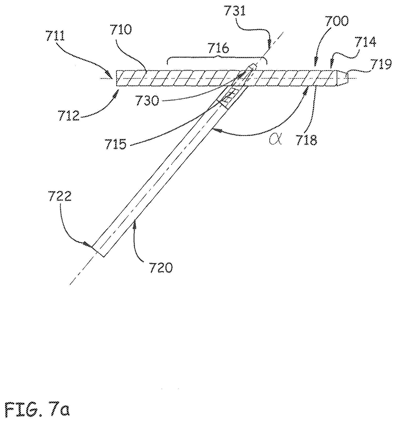 Patent US12496106 Figure 9 – Devices, methods and systems for remedying or preventing fractures