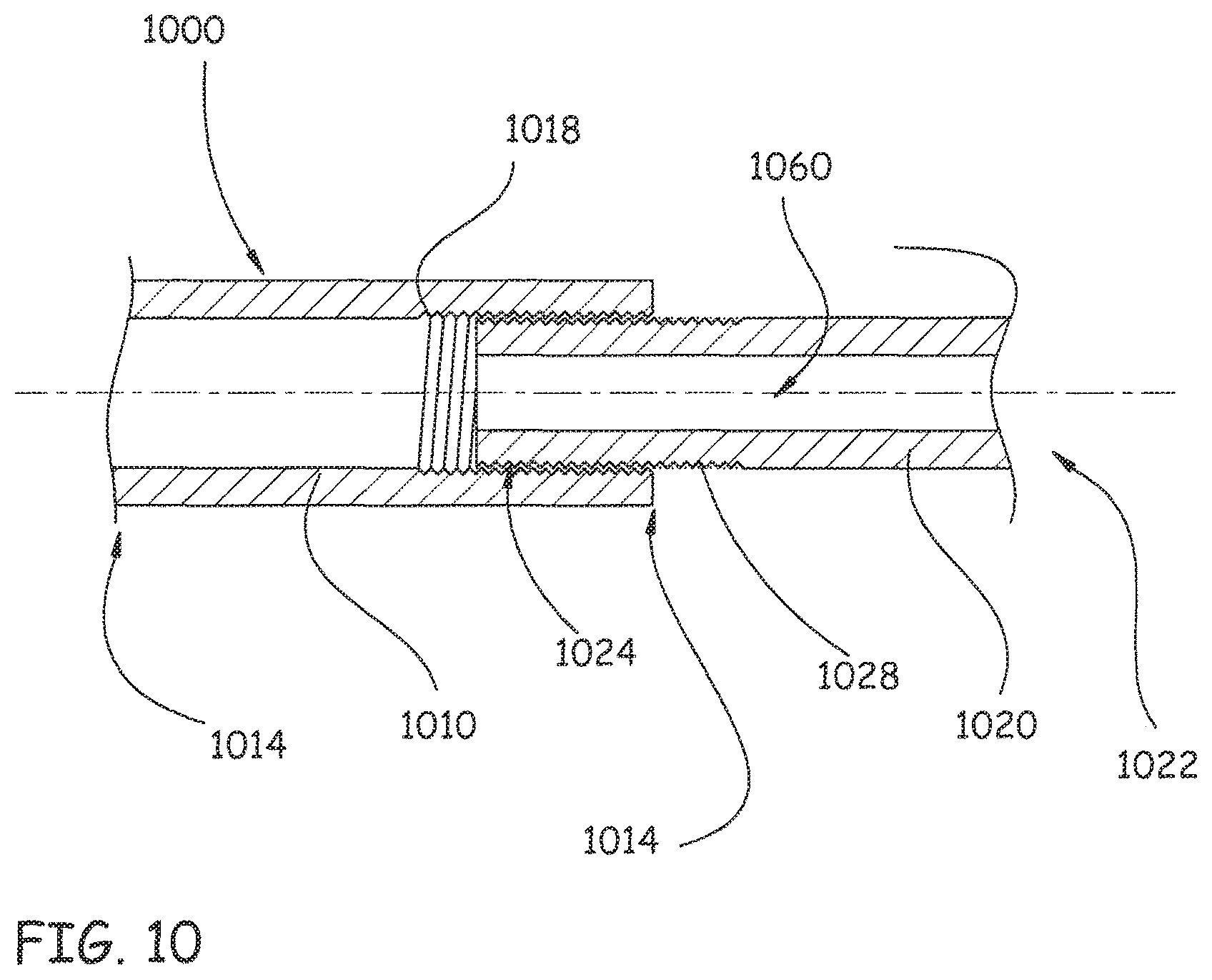 Patent US12496106 Figure 13 – Devices, methods and systems for remedying or preventing fractures