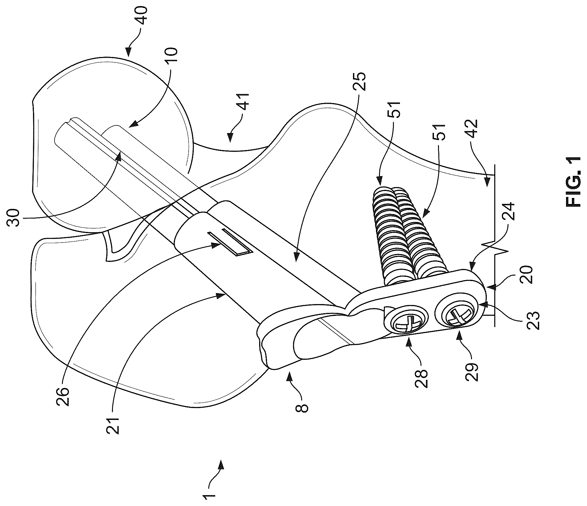 Patent US12496107 Figure 1 – Fracture fixation system