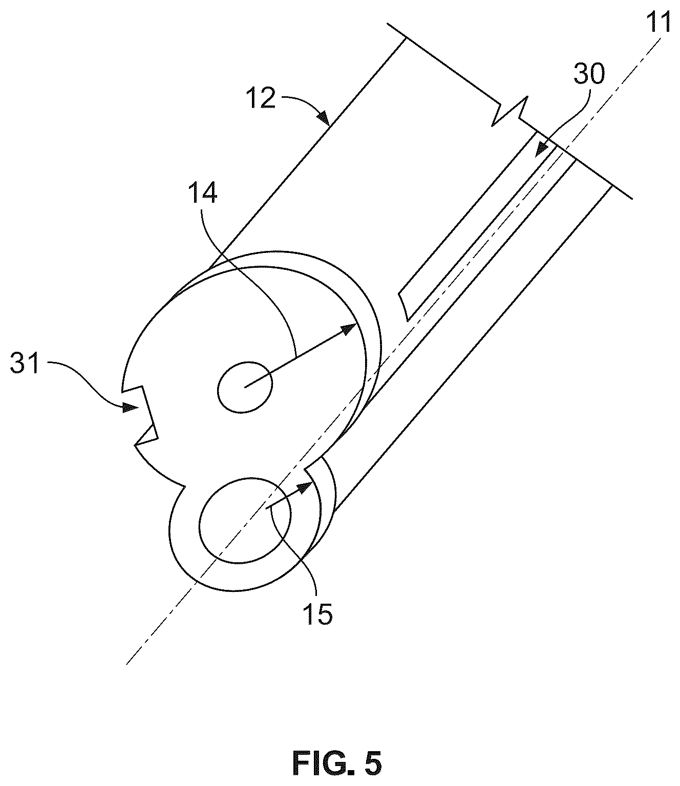 Patent US12496107 Figure 4 – Fracture fixation system