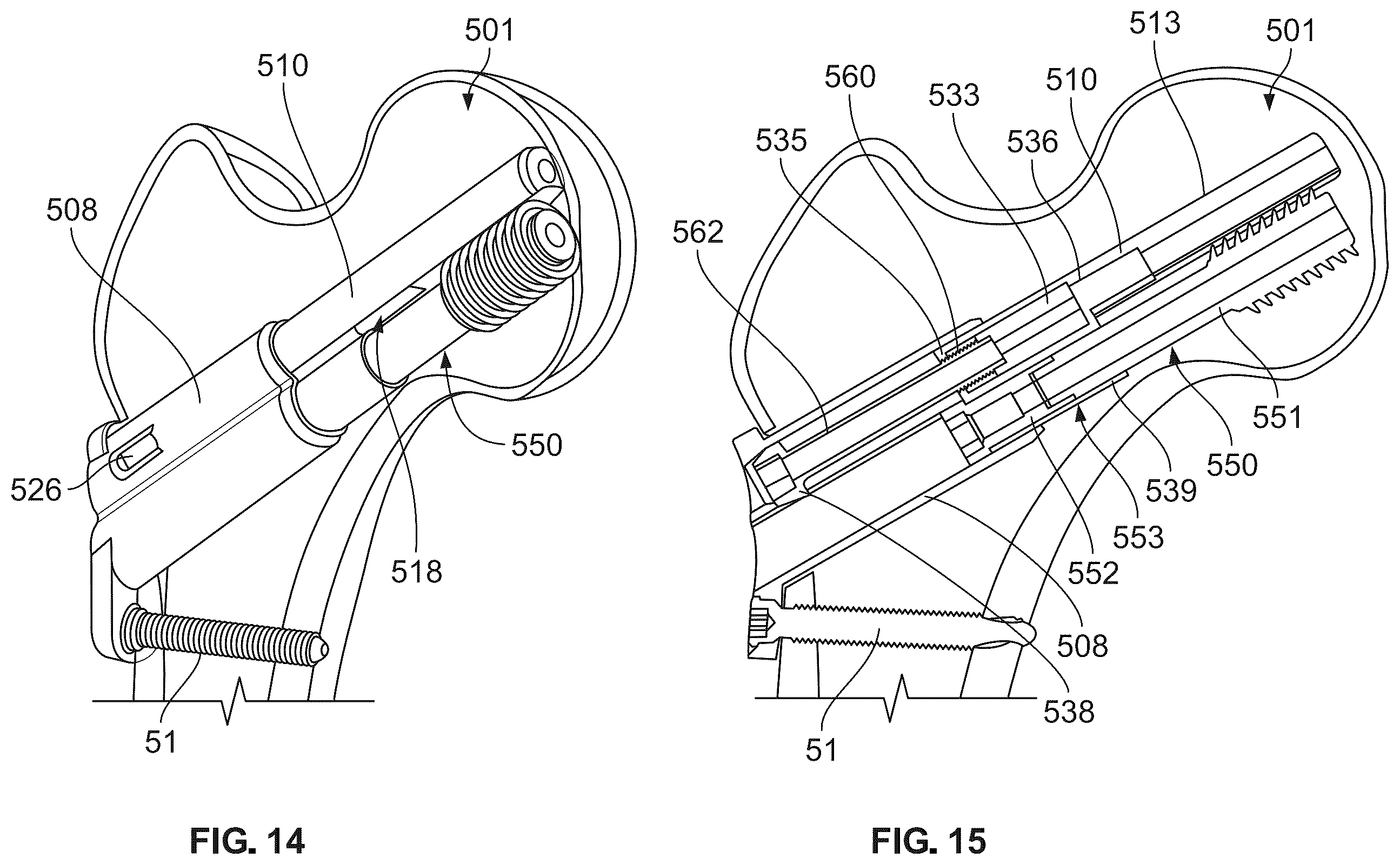 Patent US12496107 Figure 12 – Fracture fixation system
