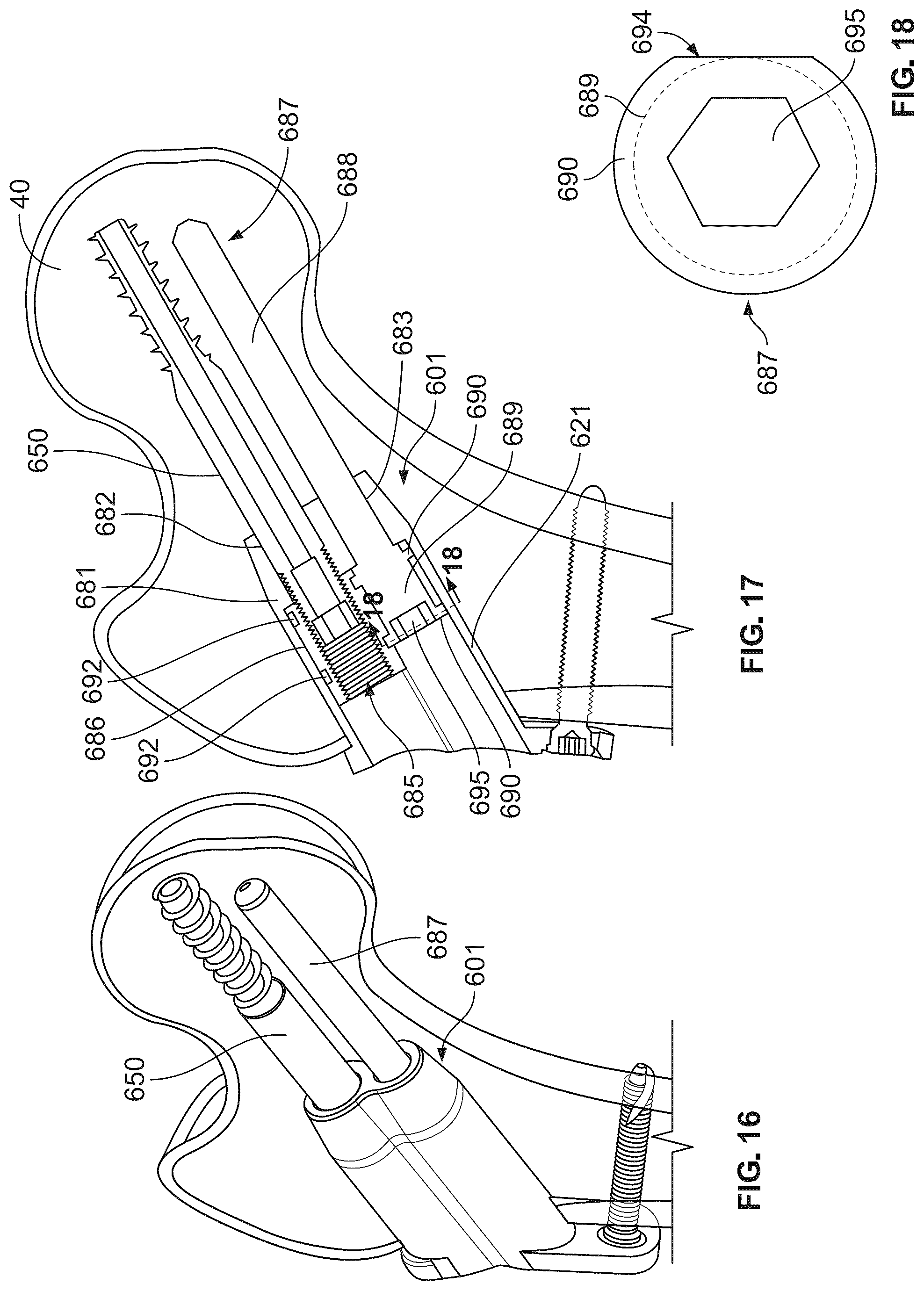 Patent US12496107 Figure 13 – Fracture fixation system