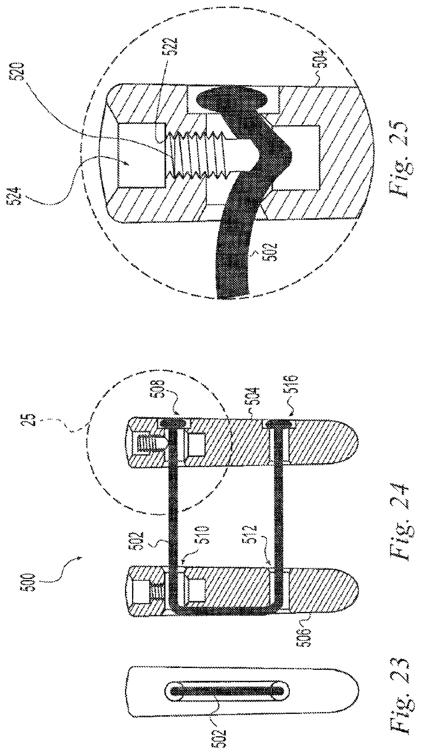 Patent US12496108 Figure 8 – Orthopedic fasteners, instruments and methods