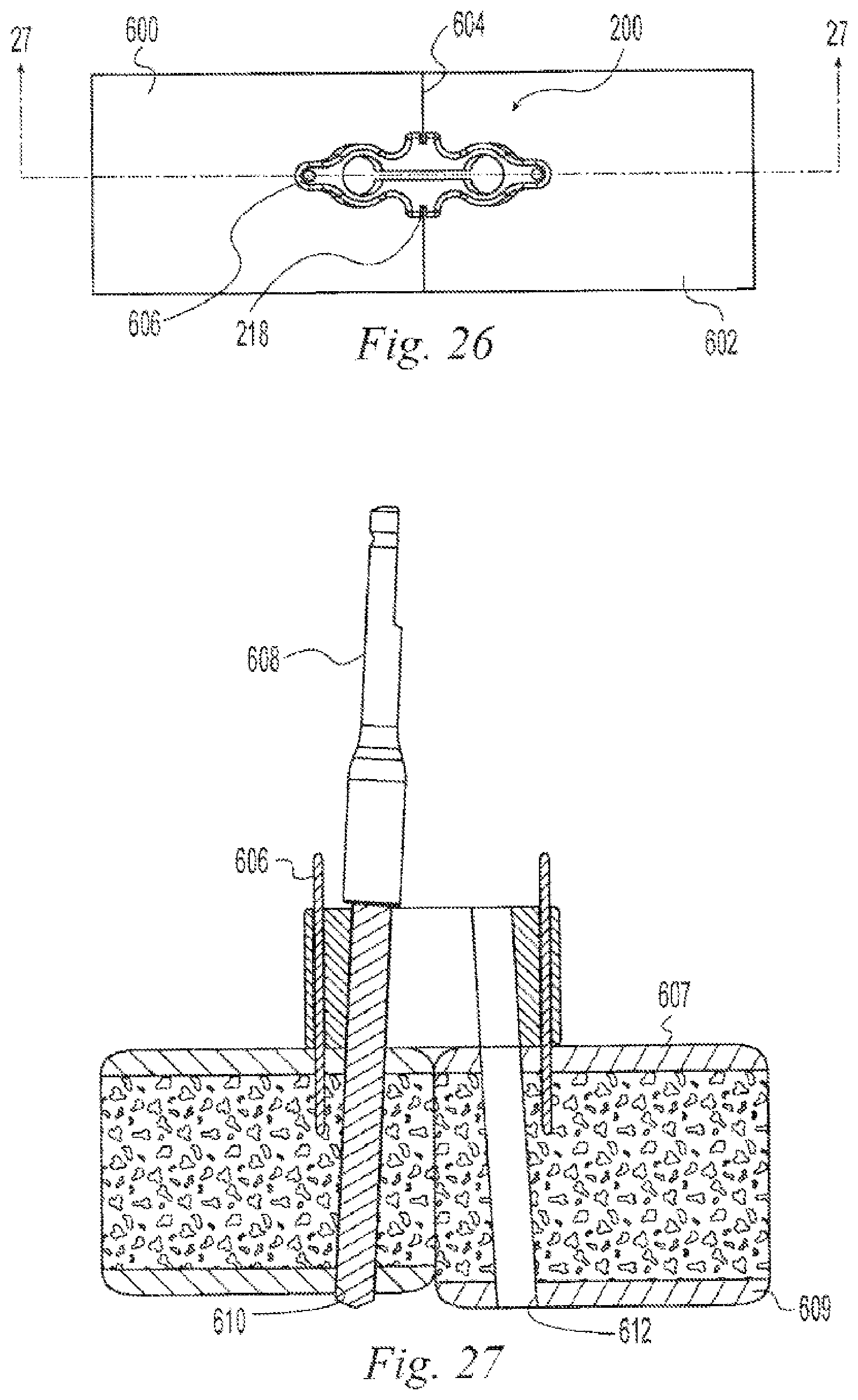 Patent US12496108 Figure 9 – Orthopedic fasteners, instruments and methods
