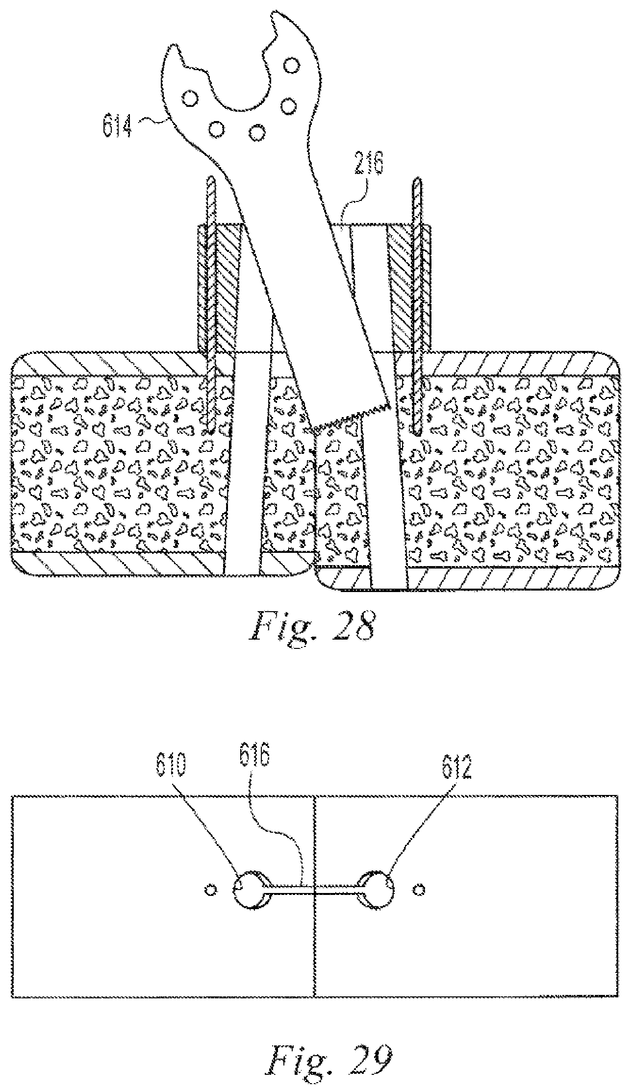 Patent US12496108 Figure 10 – Orthopedic fasteners, instruments and methods