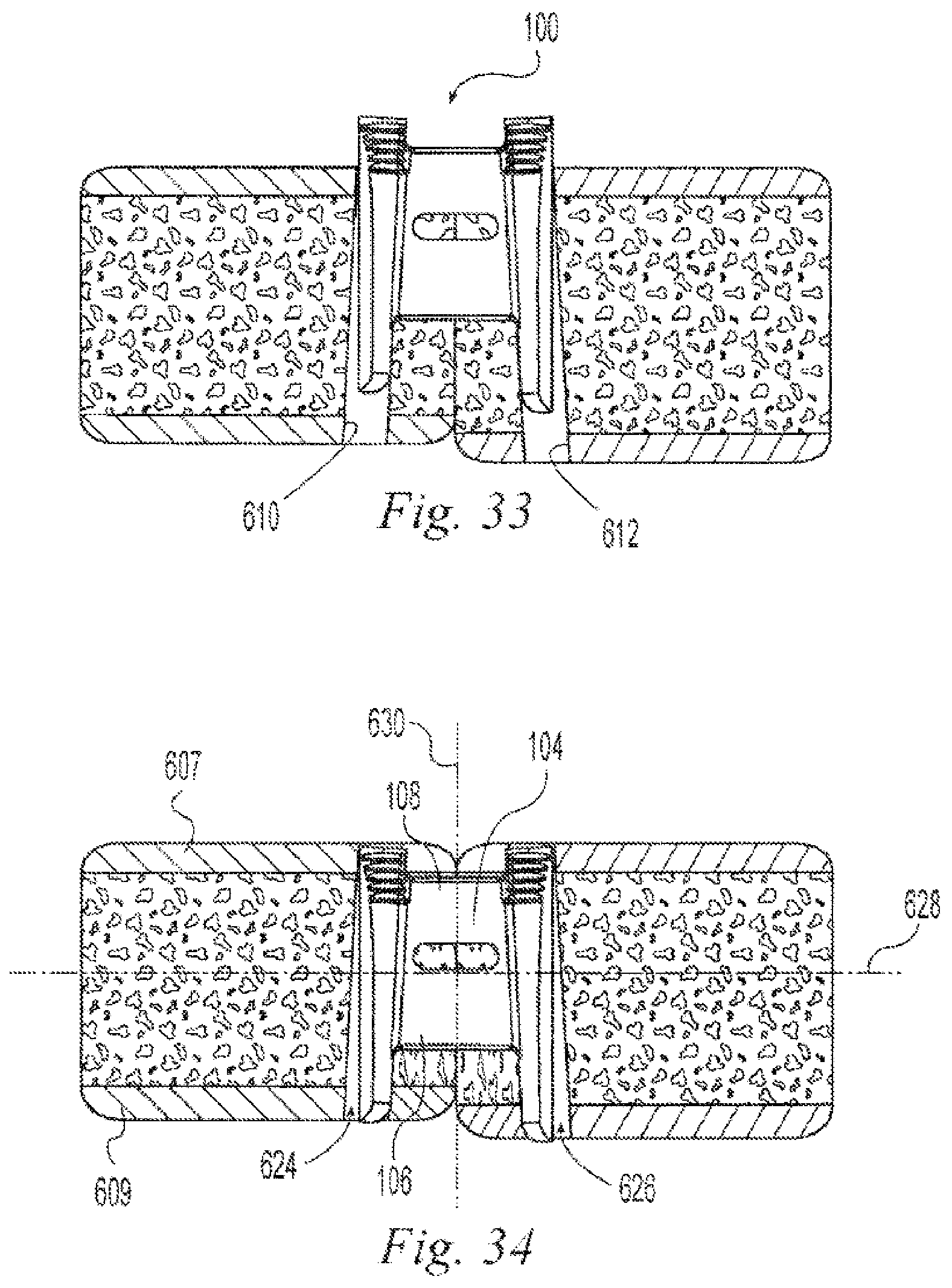 Patent US12496108 Figure 13 – Orthopedic fasteners, instruments and methods