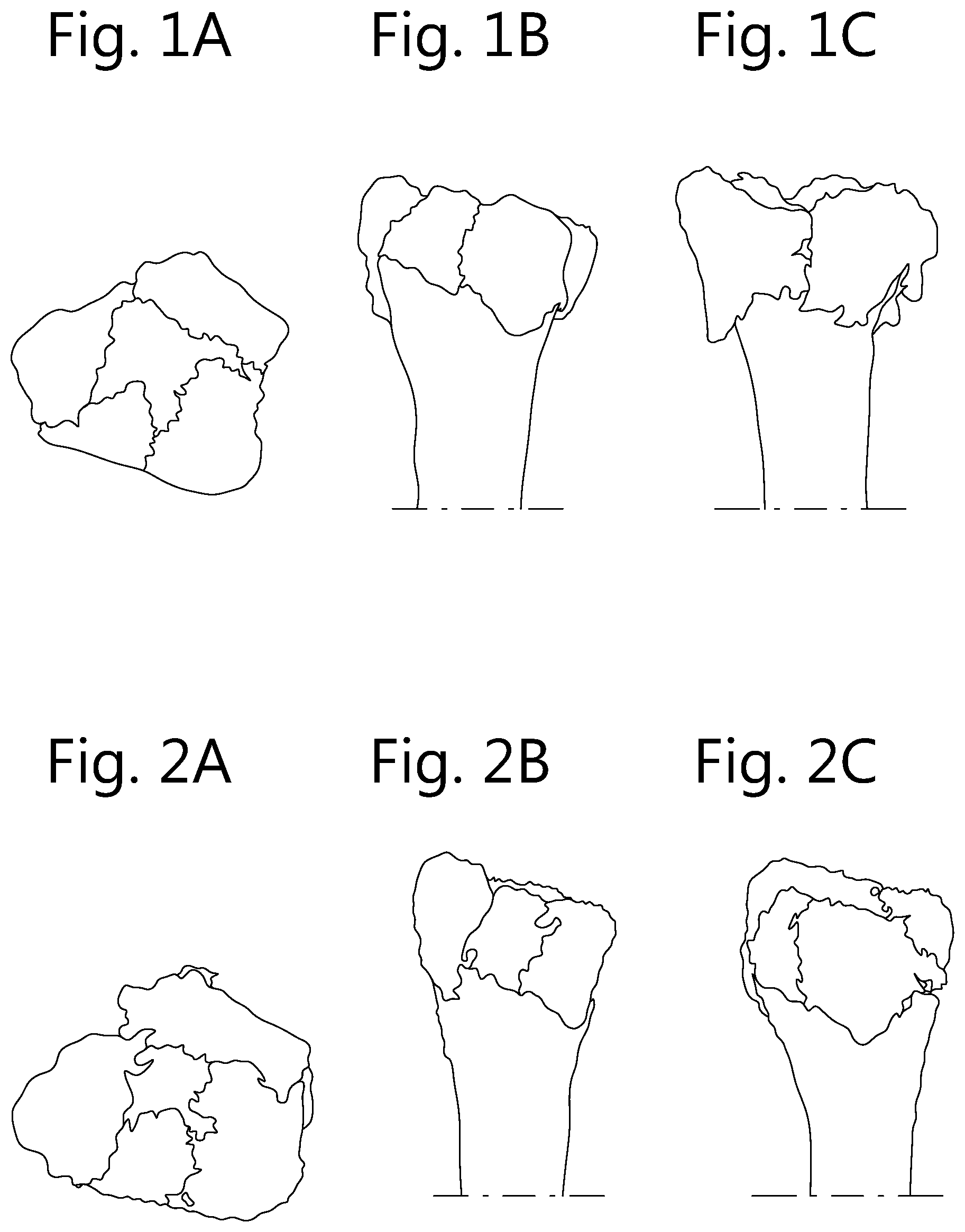 Patent US12496109 — Implantable plate and method of manufacturing thereof — Figure 1