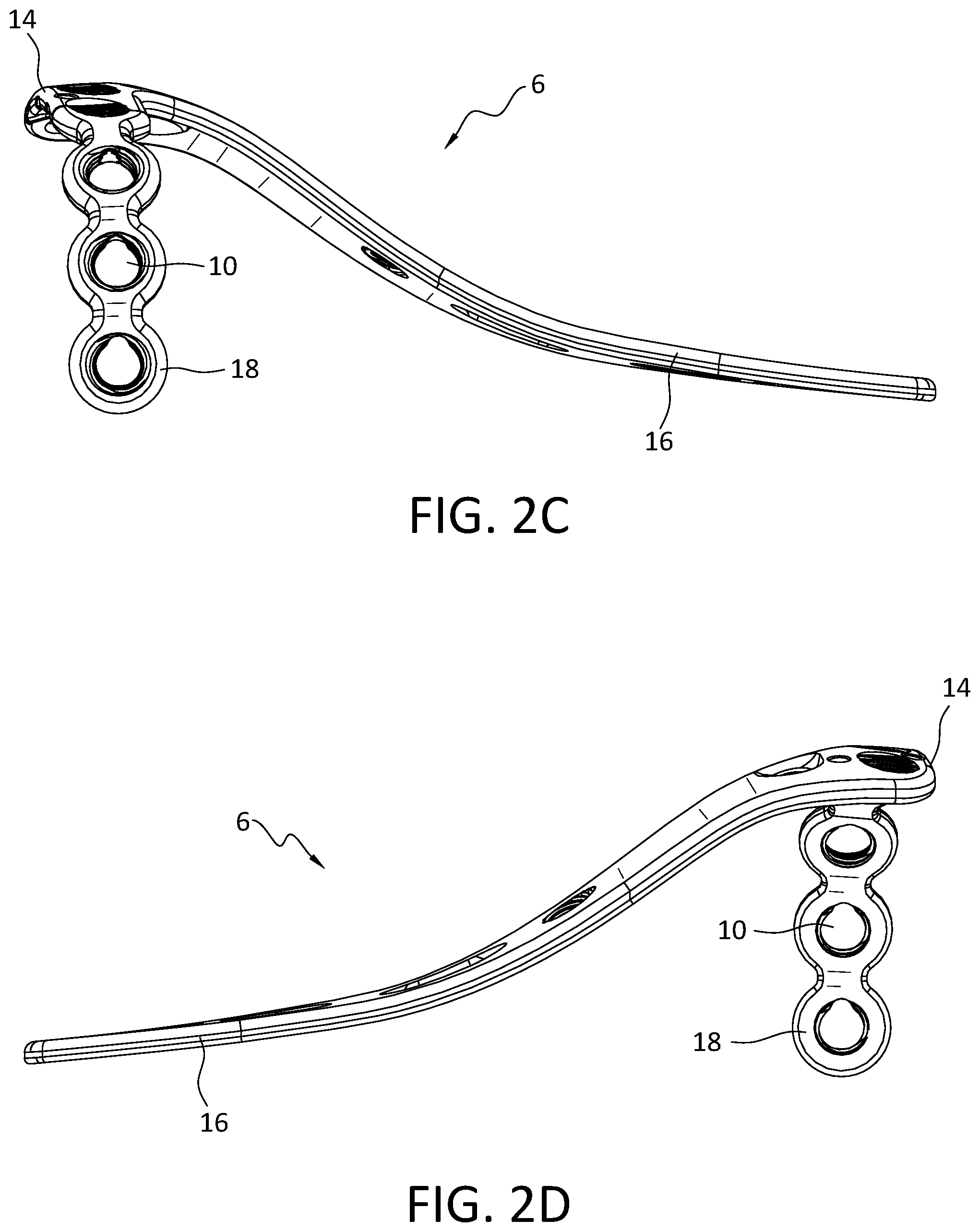 Patent US12496110 Figure 4 – Lateral proximal tibia plate with extension arm