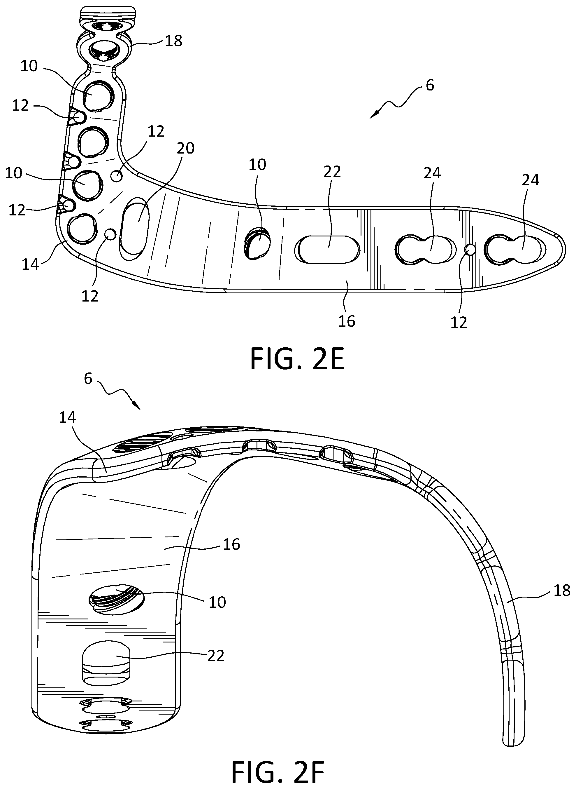 Patent US12496110 Figure 5 – Lateral proximal tibia plate with extension arm