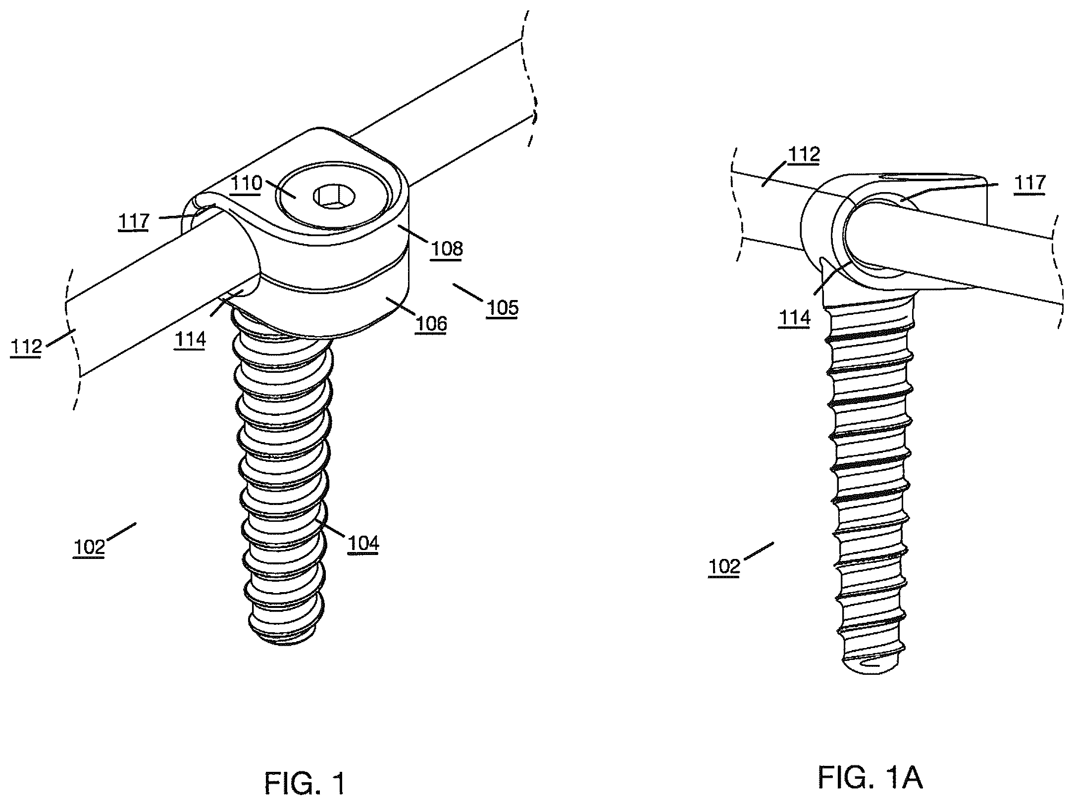 Patent US12496112 Figure 1 – Anchor device for bone implantation during surgical procedures
