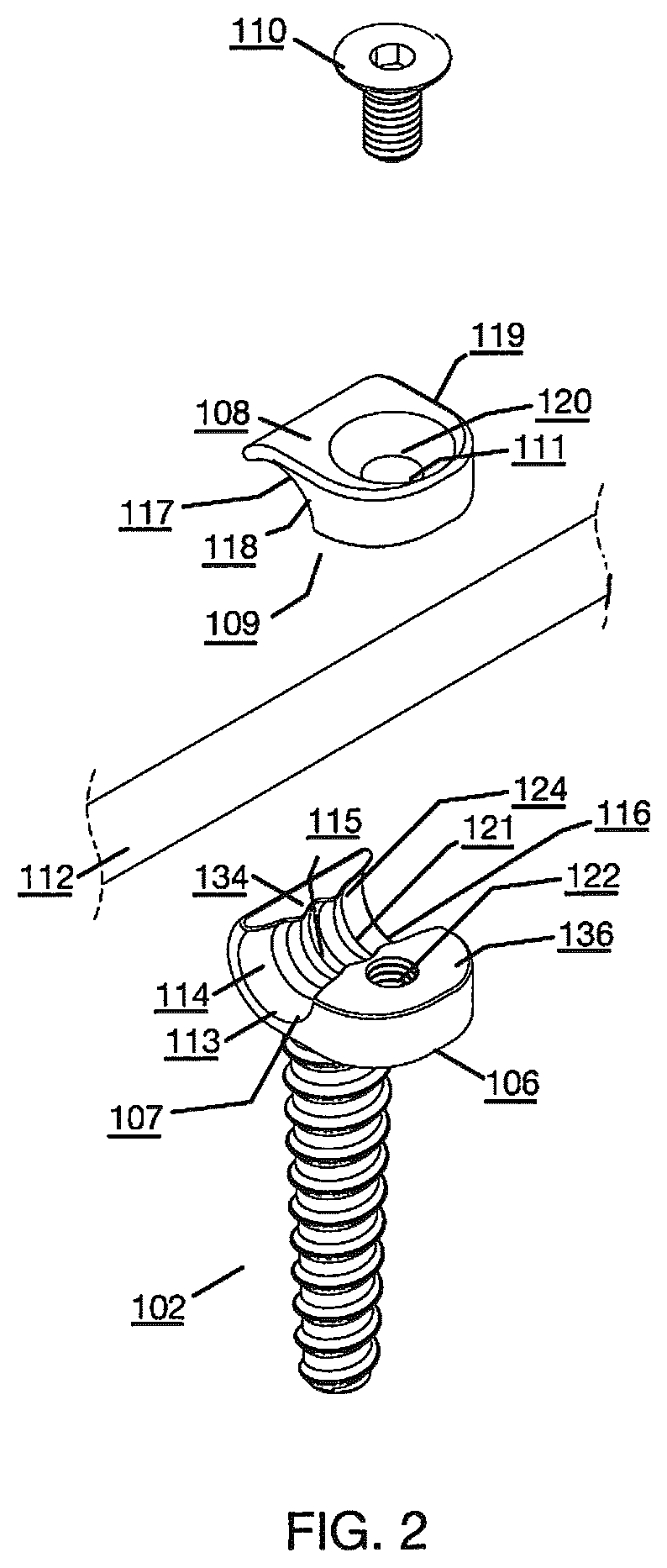 Patent US12496112 Figure 2 – Anchor device for bone implantation during surgical procedures