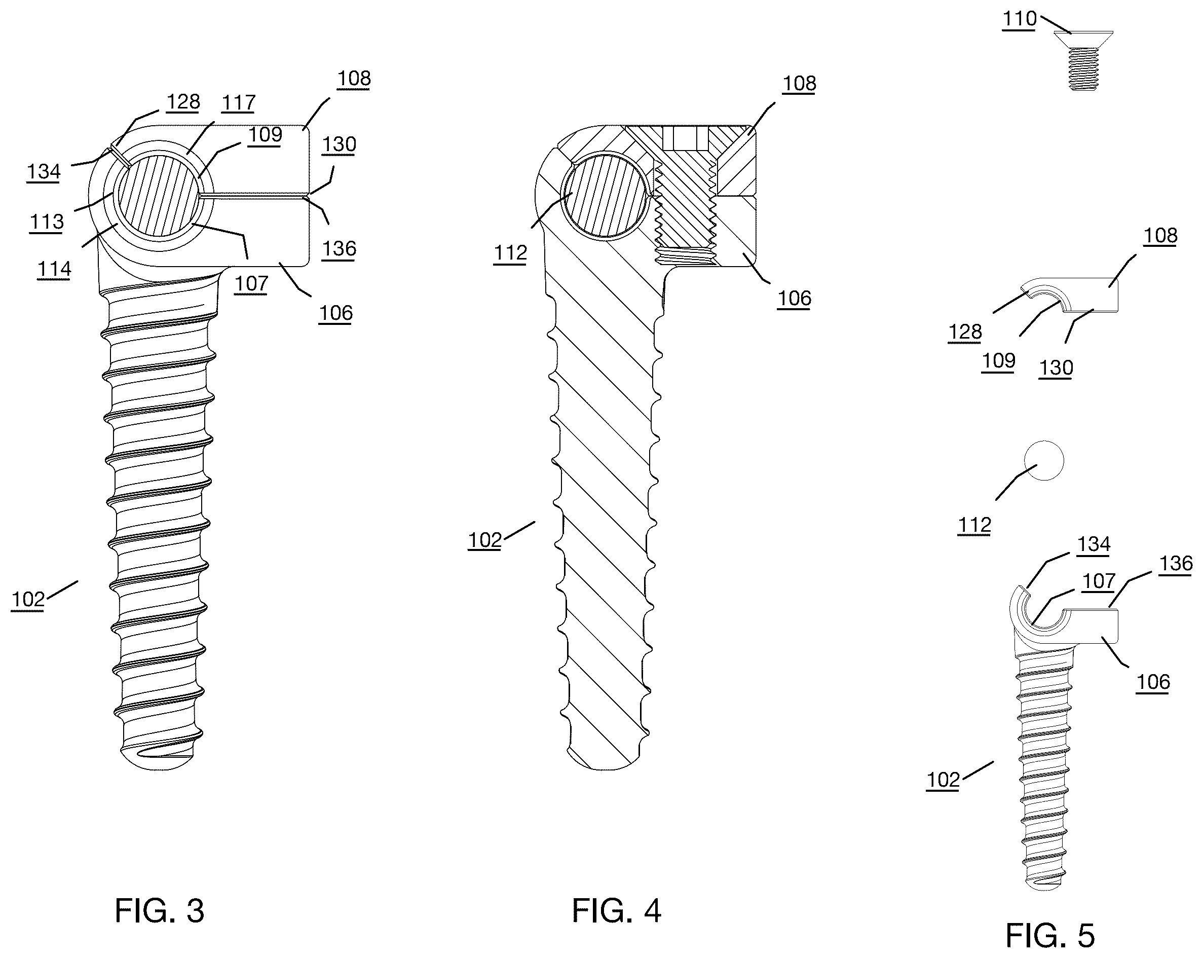 Patent US12496112 Figure 3 – Anchor device for bone implantation during surgical procedures