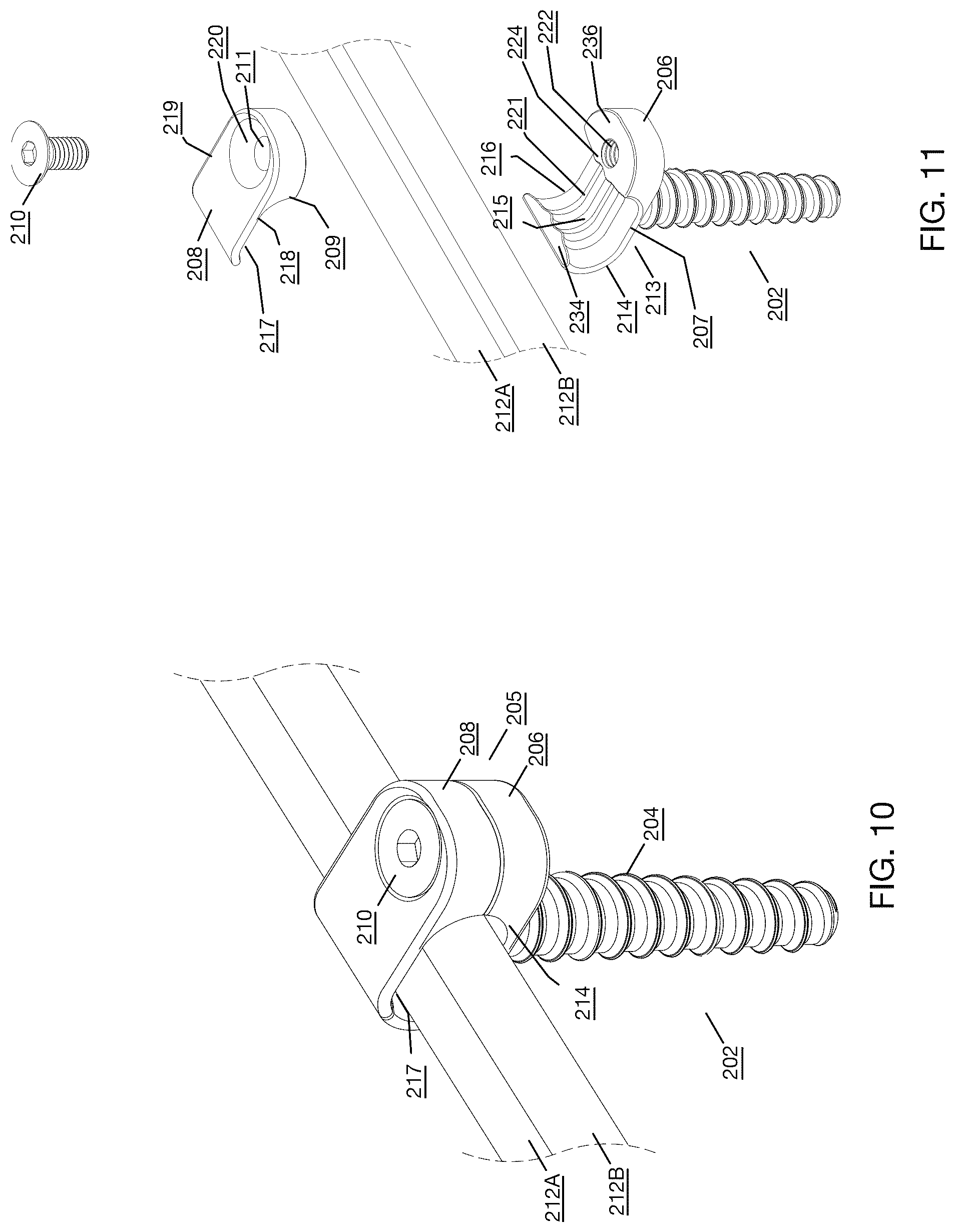 Patent US12496112 Figure 7 – Anchor device for bone implantation during surgical procedures