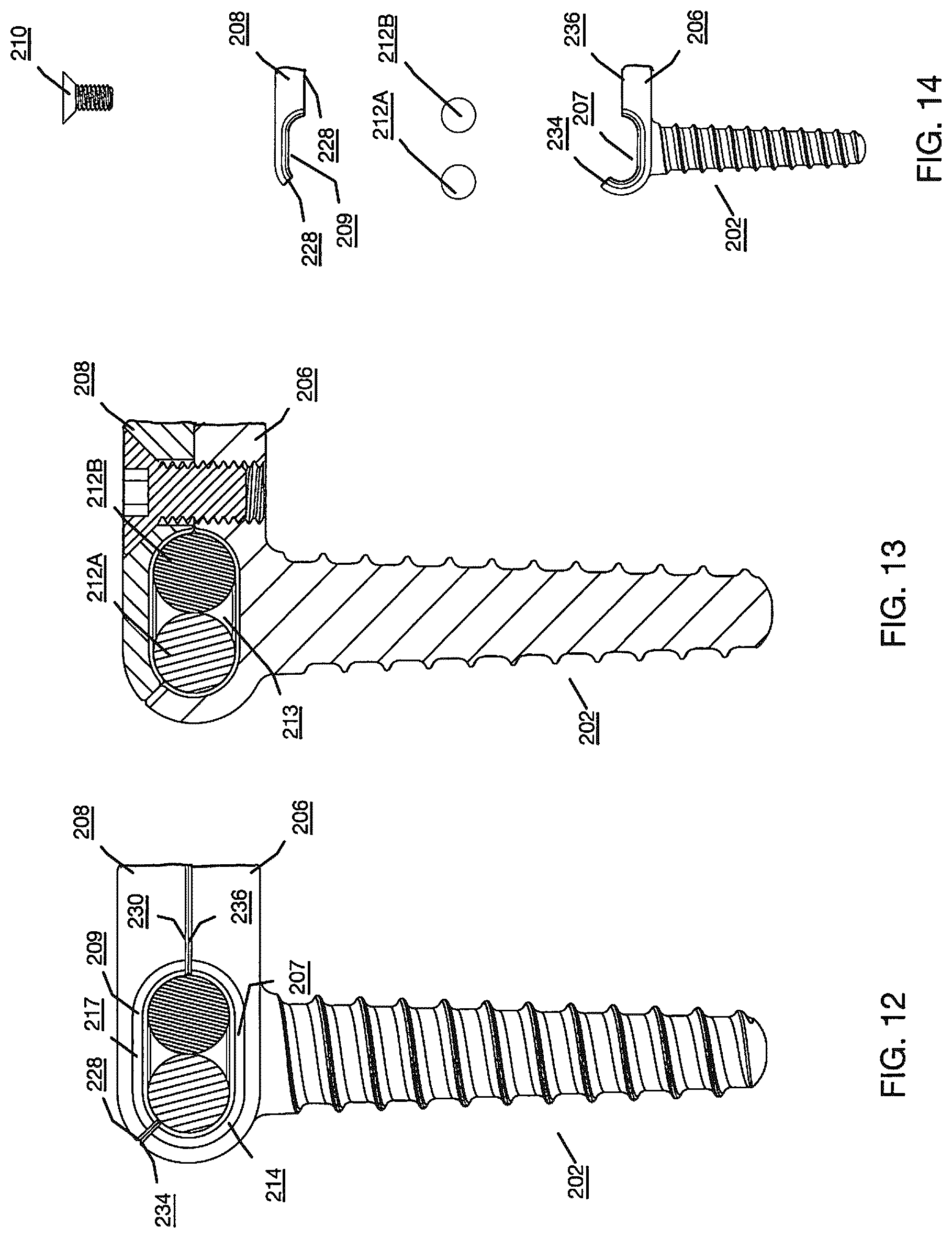 Patent US12496112 Figure 8 – Anchor device for bone implantation during surgical procedures