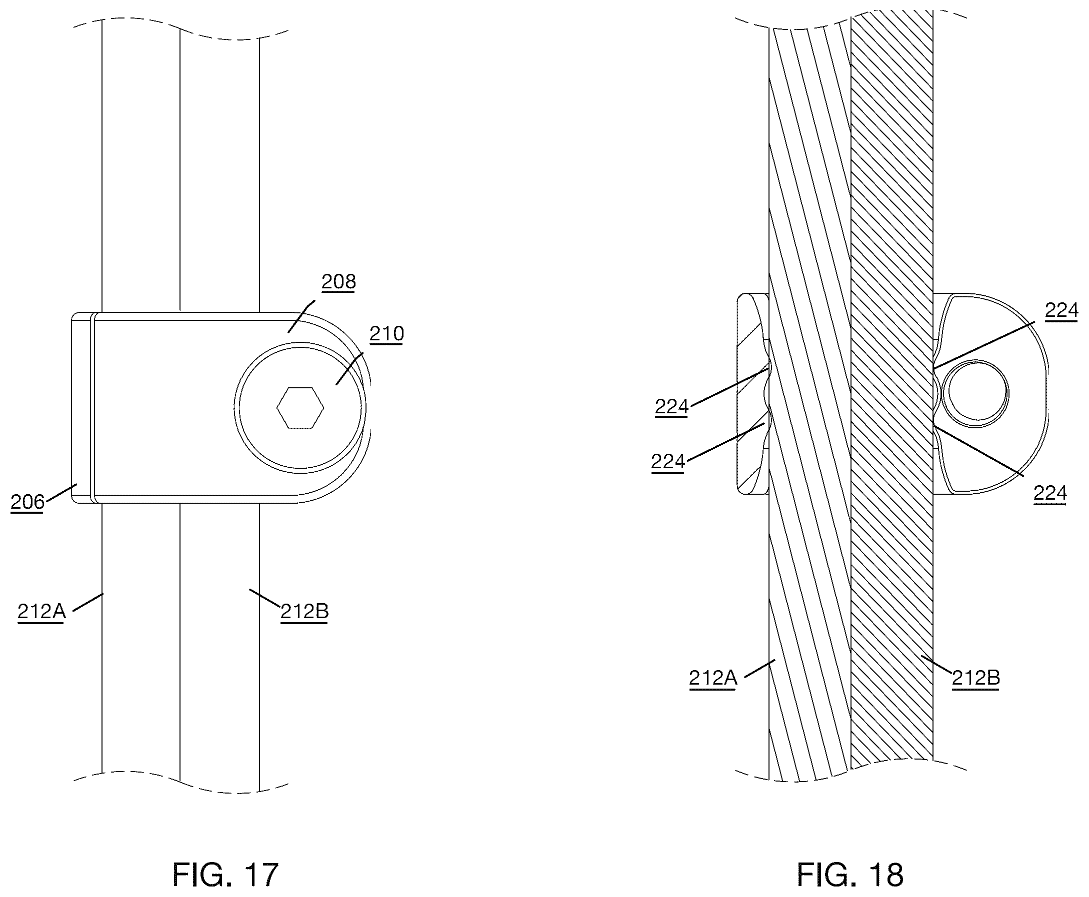 Patent US12496112 Figure 10 – Anchor device for bone implantation during surgical procedures