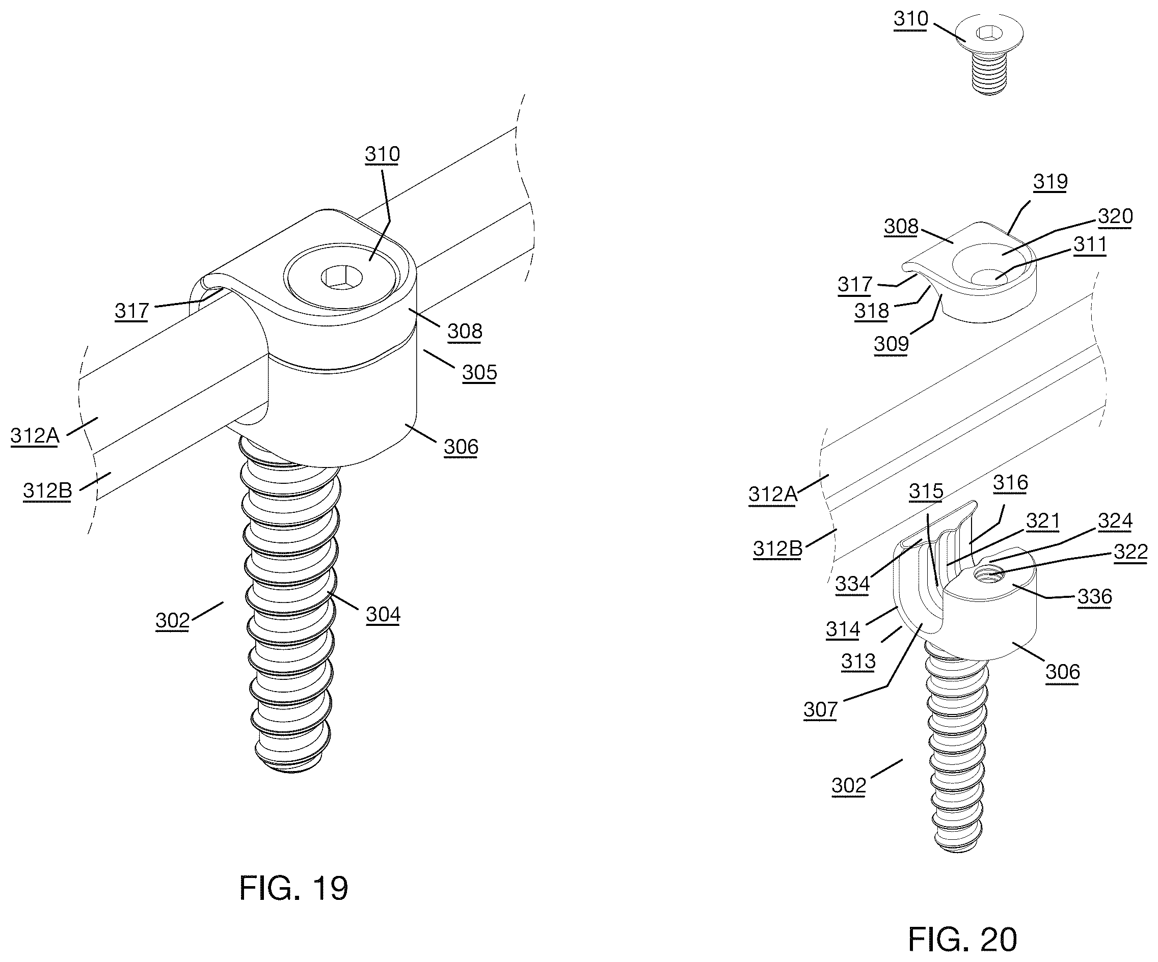 Patent US12496112 Figure 11 – Anchor device for bone implantation during surgical procedures