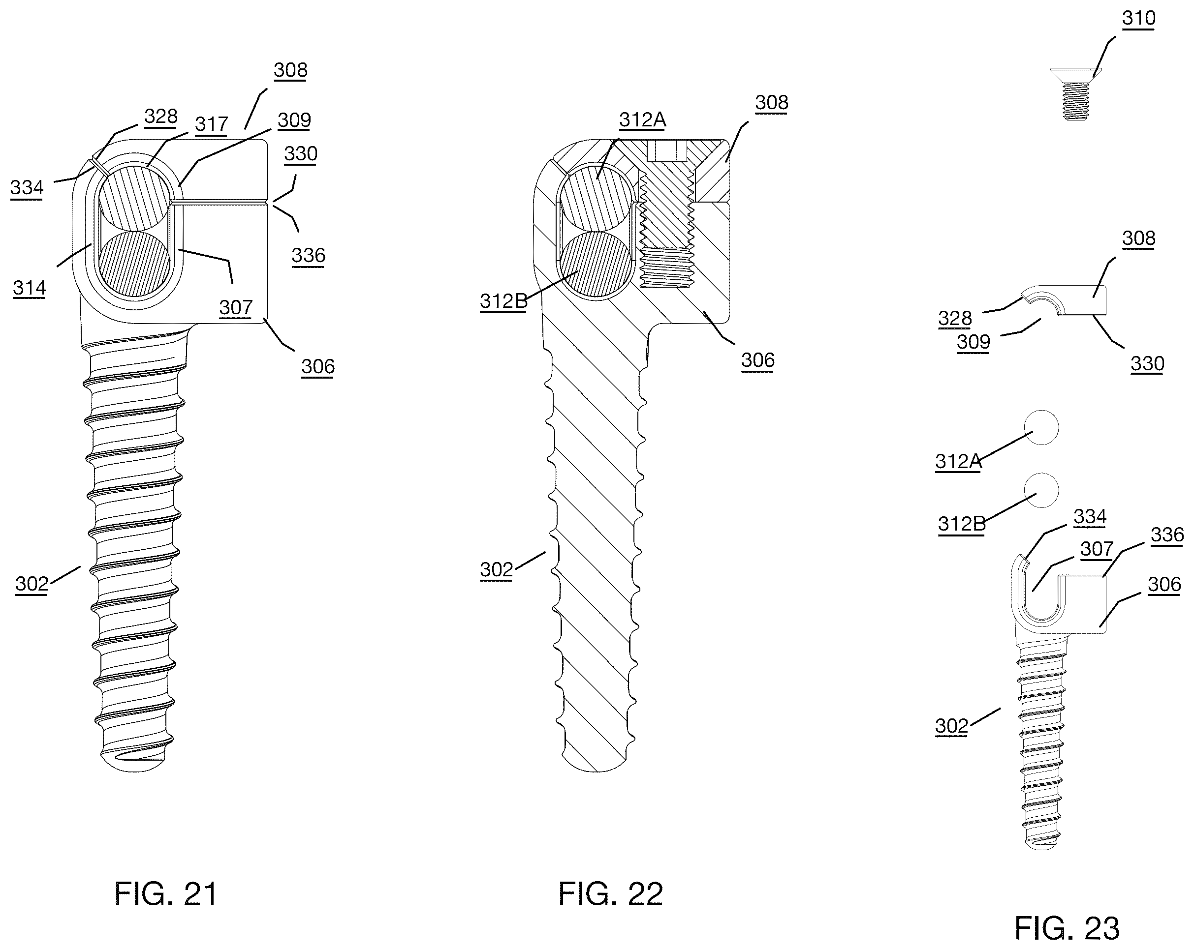 Patent US12496112 Figure 12 – Anchor device for bone implantation during surgical procedures