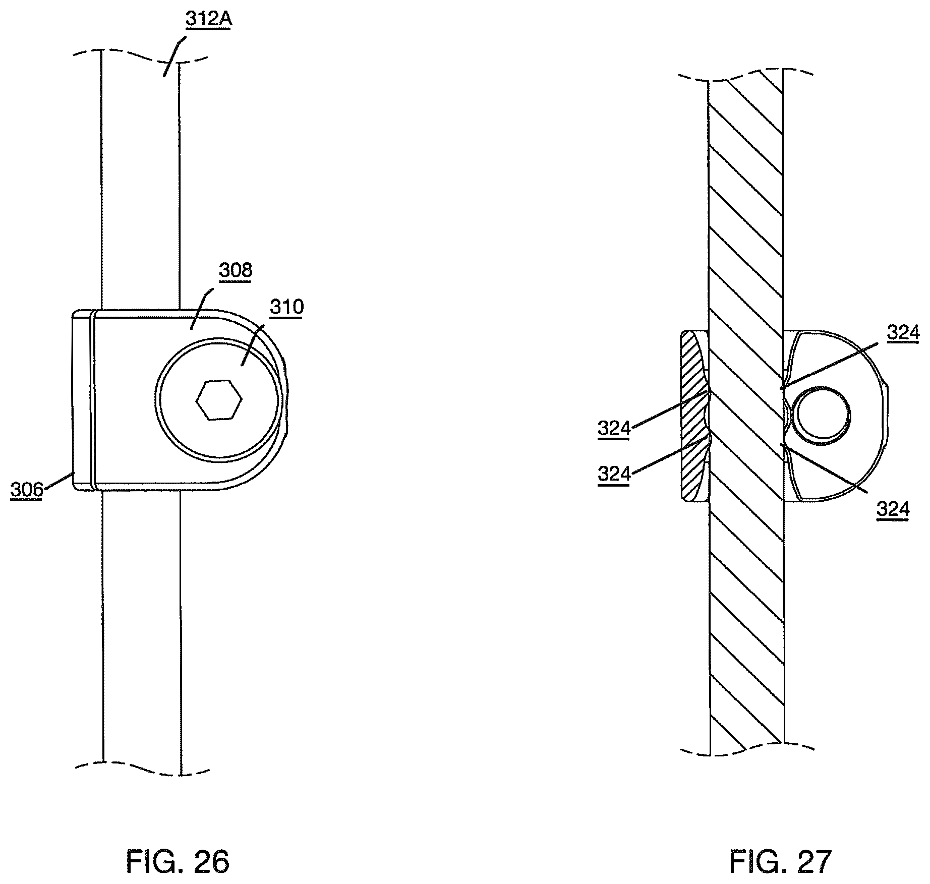 Patent US12496112 Figure 14 – Anchor device for bone implantation during surgical procedures