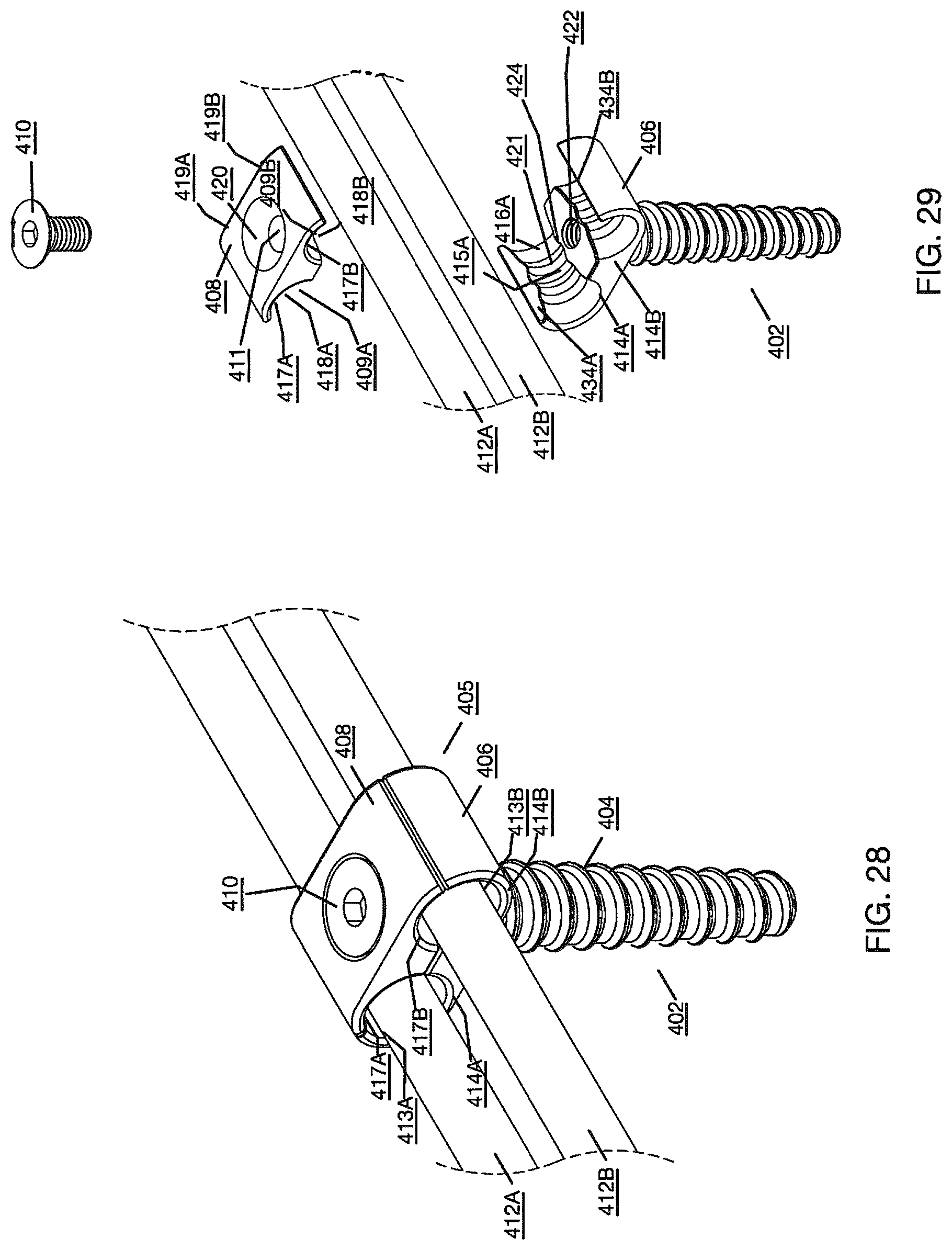 Patent US12496112 Figure 15 – Anchor device for bone implantation during surgical procedures