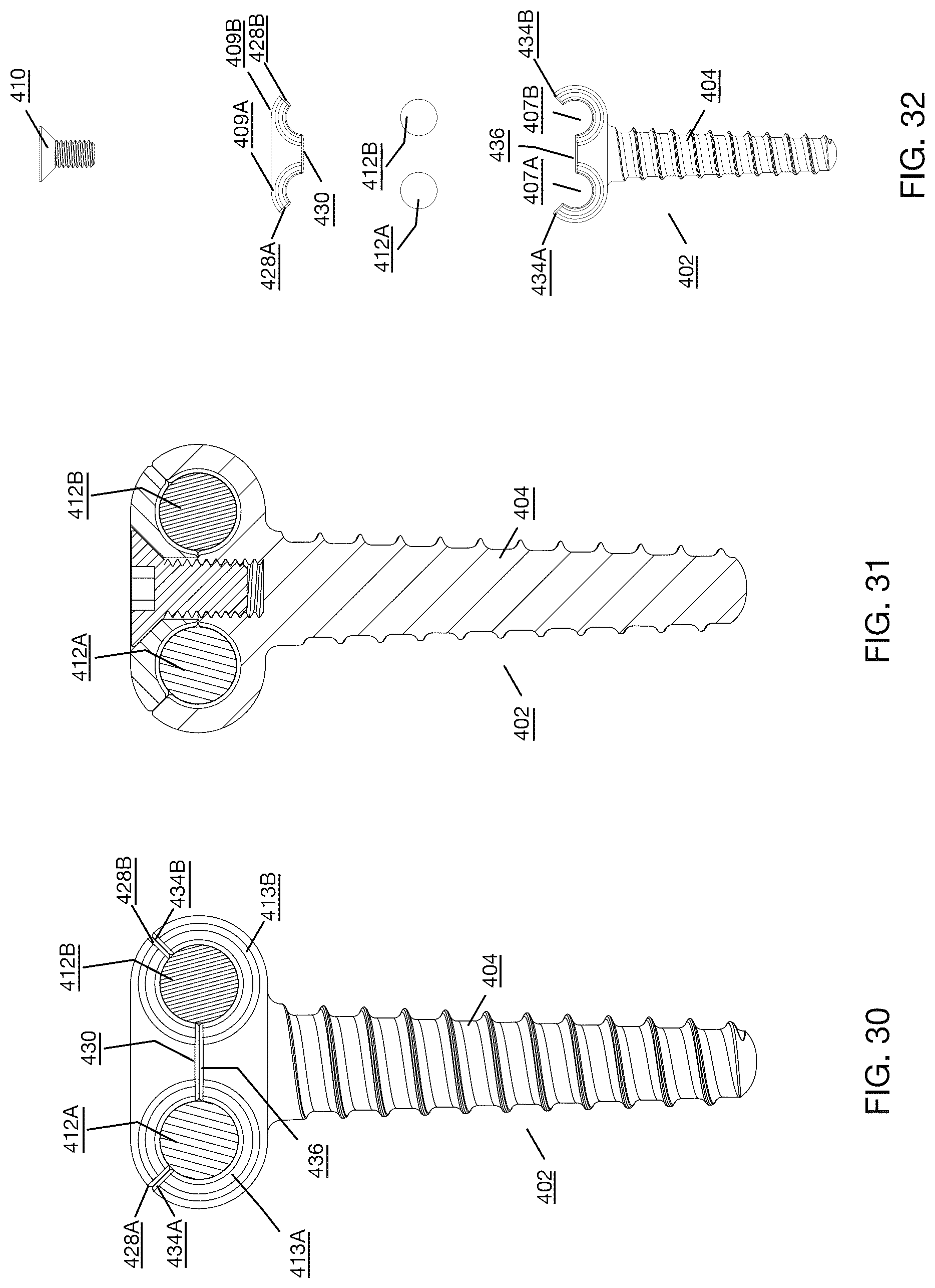 Patent US12496112 Figure 16 – Anchor device for bone implantation during surgical procedures