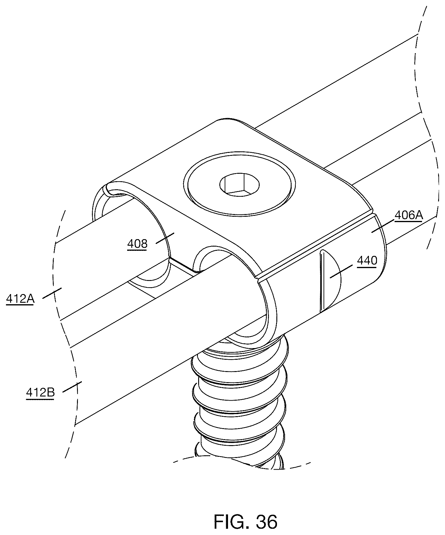 Patent US12496112 Figure 19 – Anchor device for bone implantation during surgical procedures