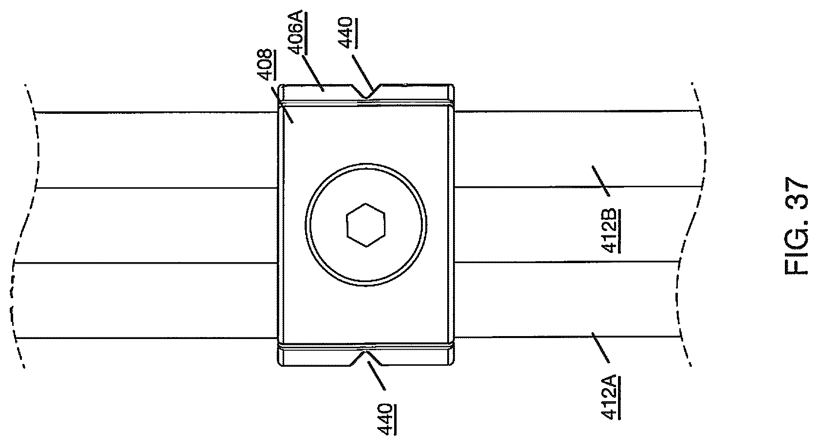 Patent US12496112 Figure 20 – Anchor device for bone implantation during surgical procedures