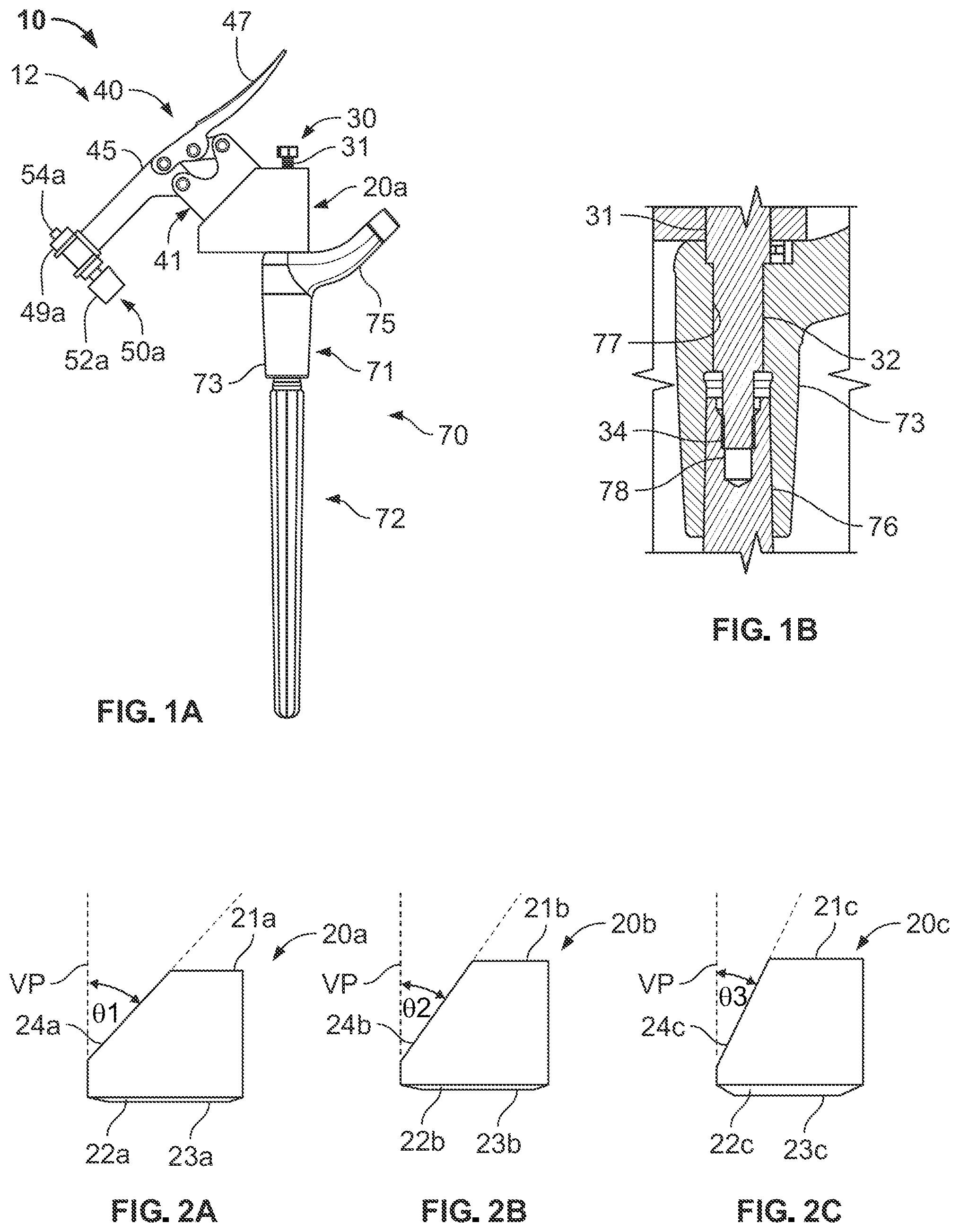 Patent US12496113 Figure 1 – Bone reattachment system