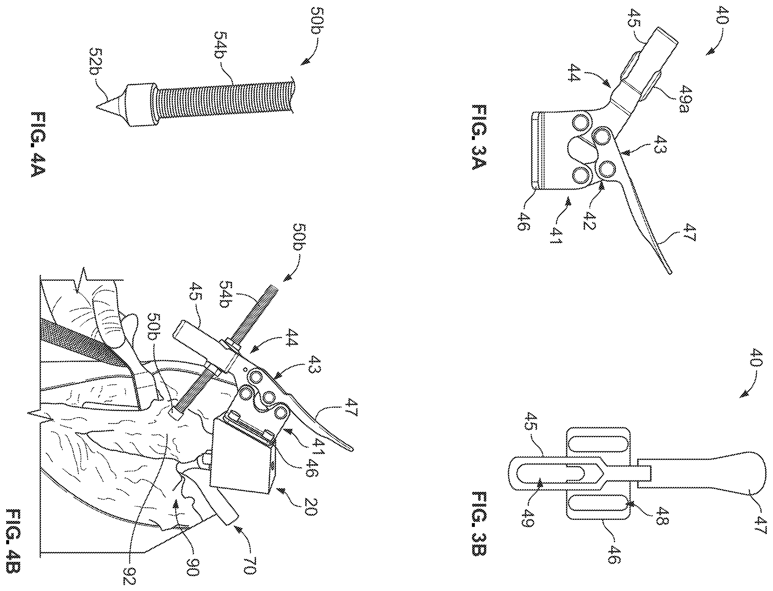 Patent US12496113 Figure 2 – Bone reattachment system