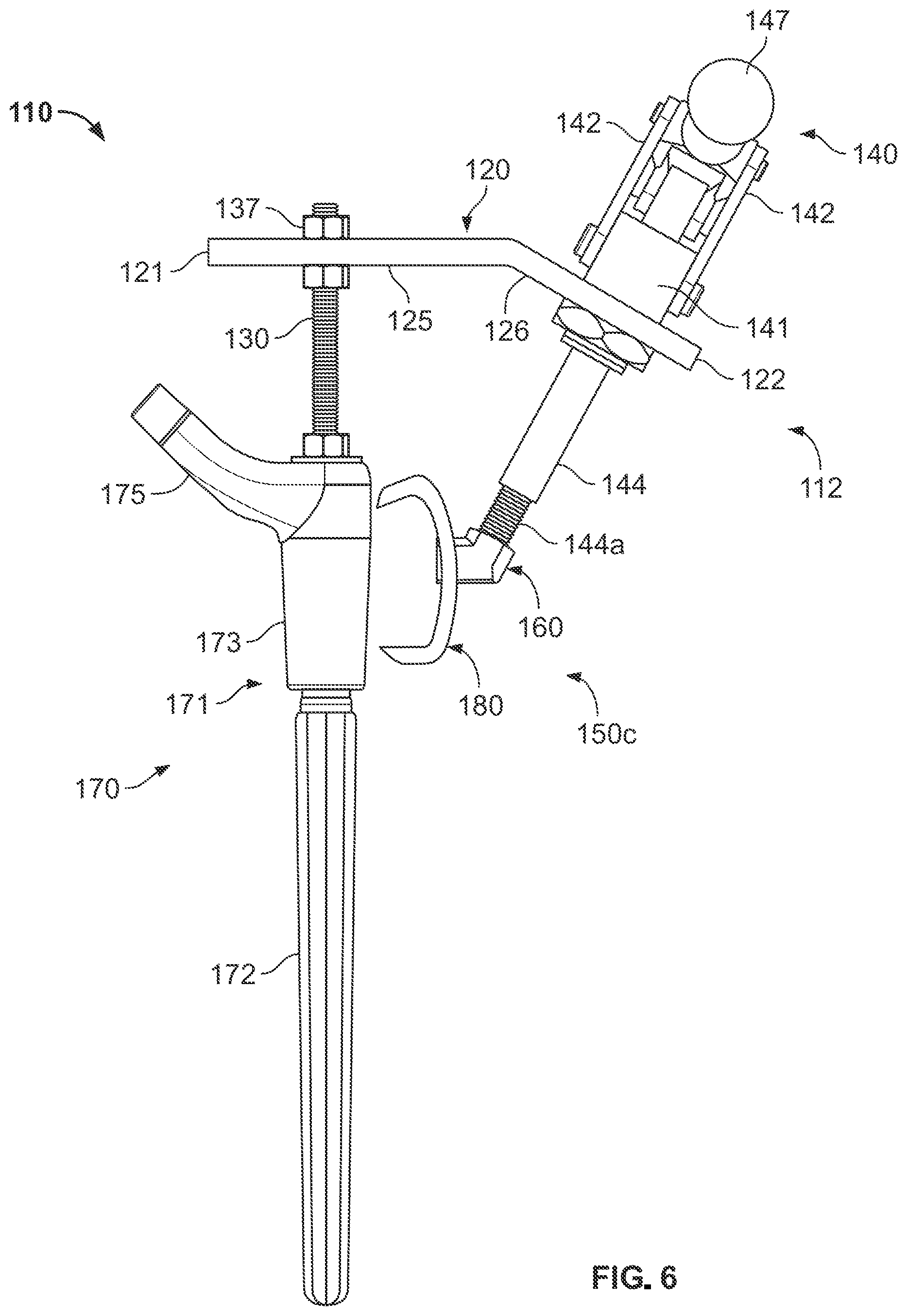 Patent US12496113 Figure 5 – Bone reattachment system