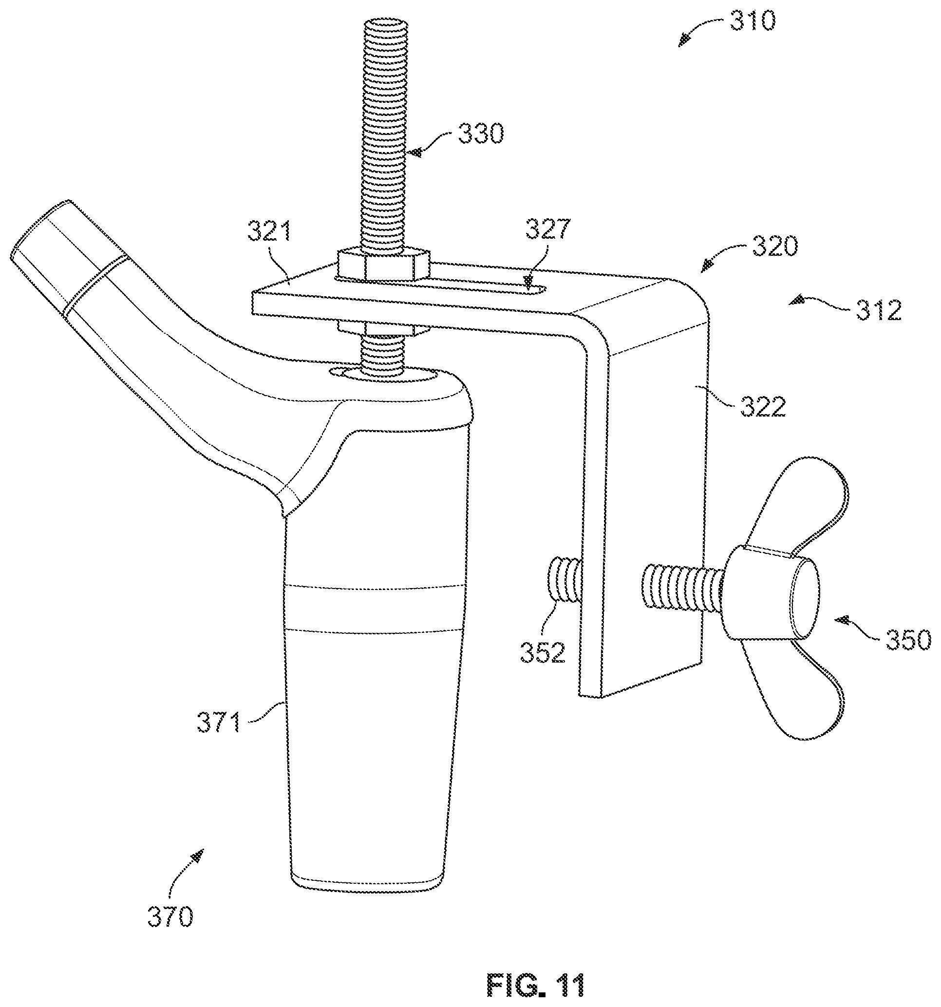 Patent US12496113 Figure 9 – Bone reattachment system