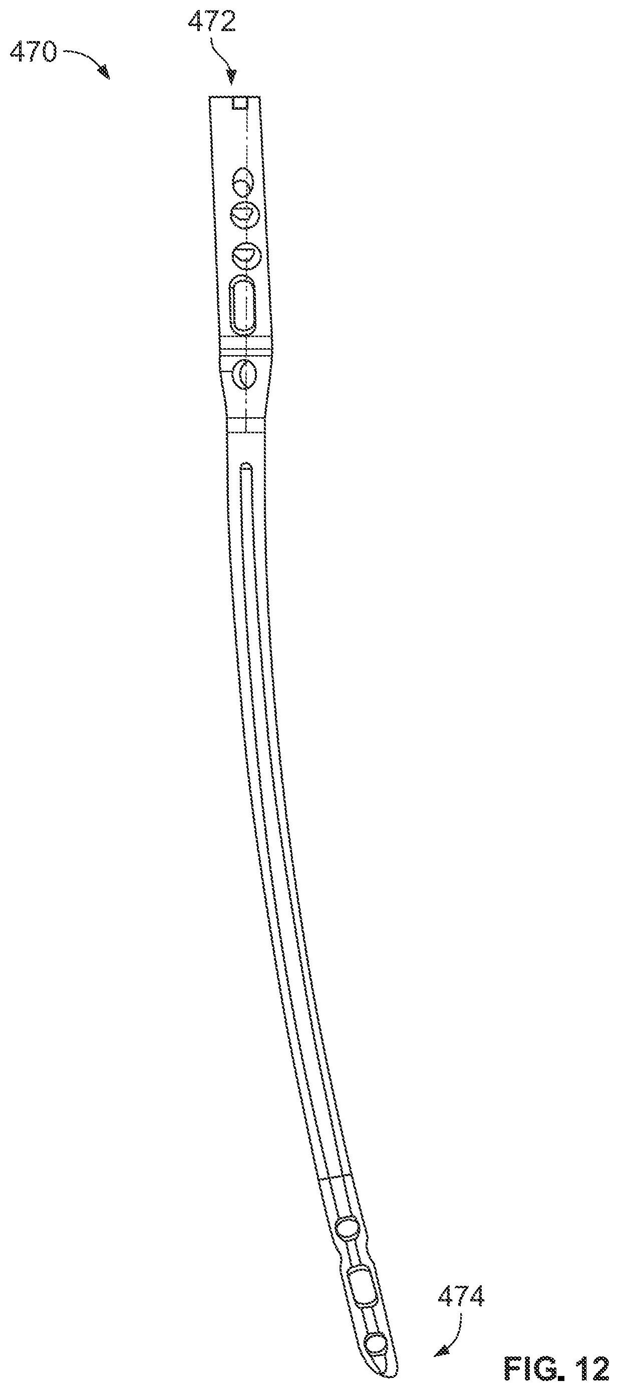 Patent US12496113 Figure 10 – Bone reattachment system