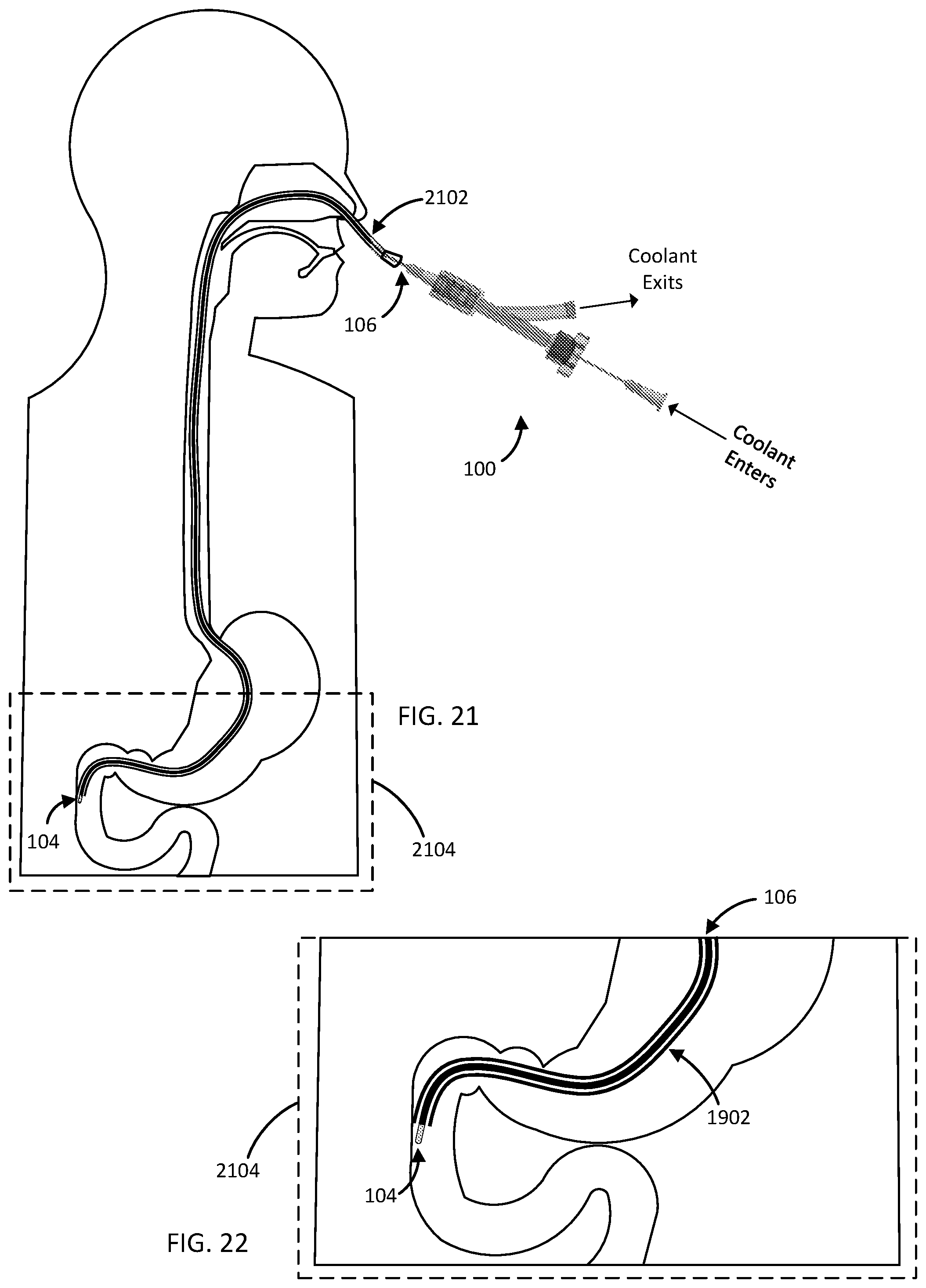 Patent US12496115 Figure 12 – Devices, systems, and methods for cryogenic biopsy sampling