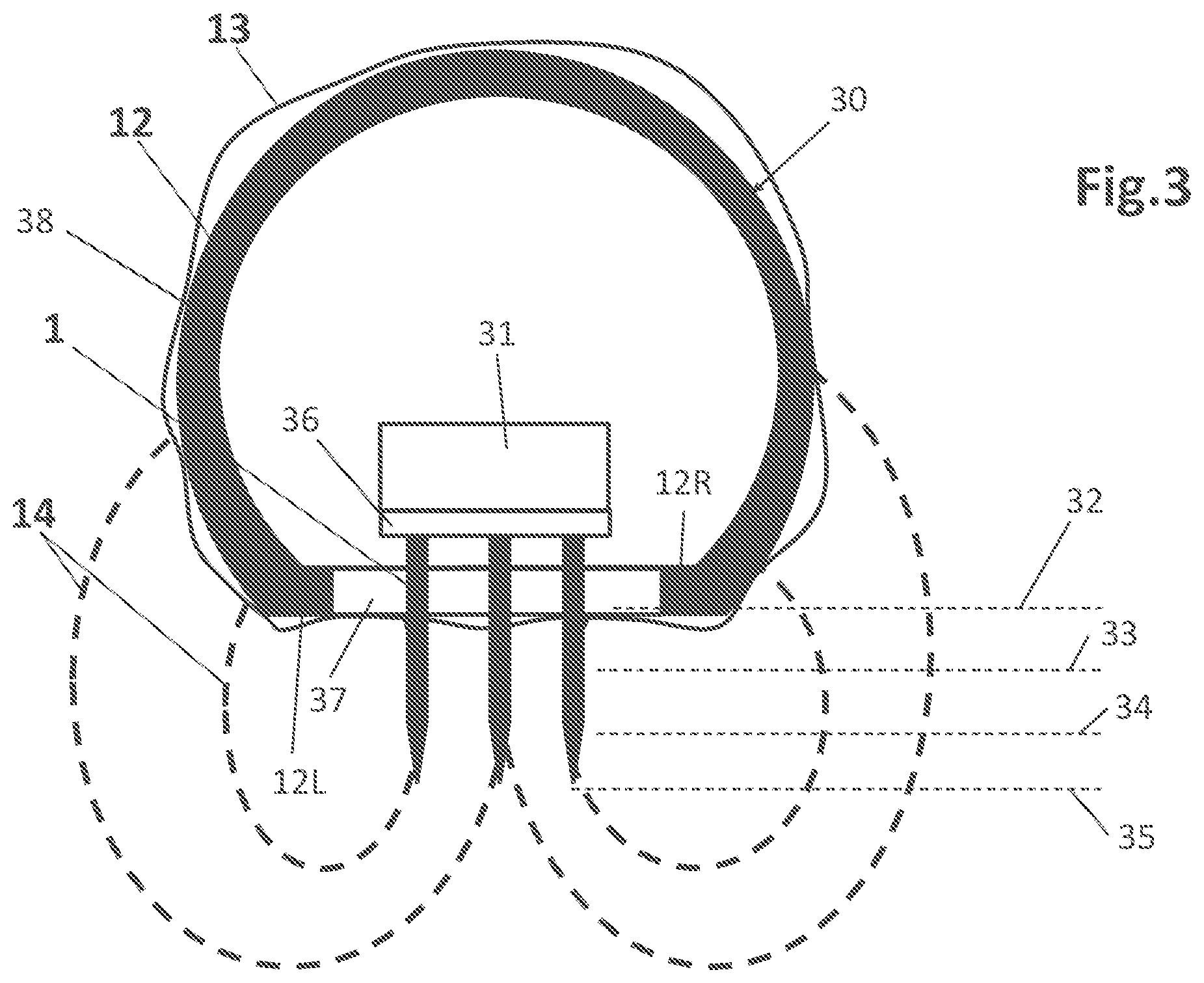 Patent US12496121 Figure 3 – RF fractional device for treatment at different tissue depths