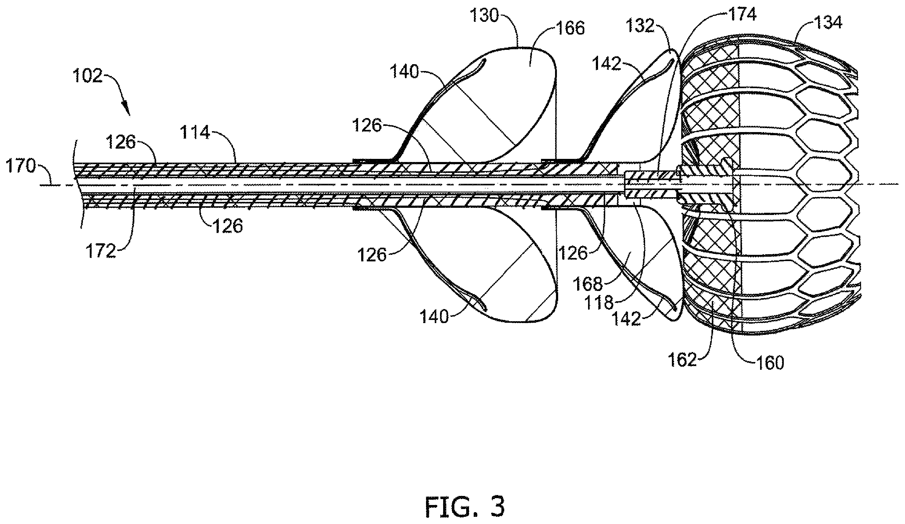Patent US12496122 Figure 3 – Ablation and occlusive system