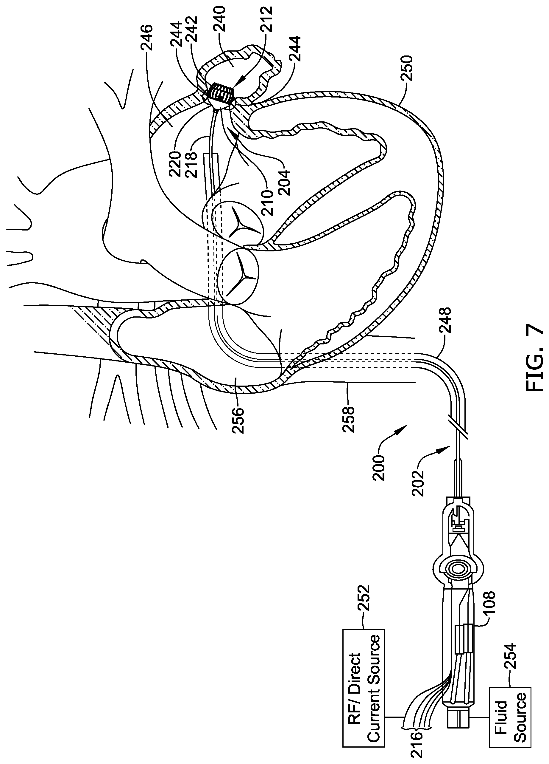 Patent US12496122 Figure 7 – Ablation and occlusive system