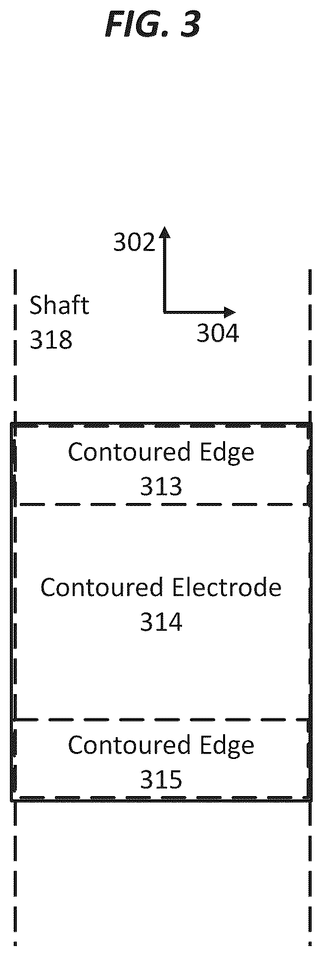 Patent US12496123 Figure 3 – Contoured electrodes for pulsed electric field ablation, and systems, devices, and methods thereof