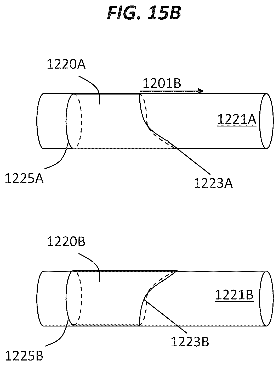 Patent US12496123 Figure 16 – Contoured electrodes for pulsed electric field ablation, and systems, devices, and methods thereof