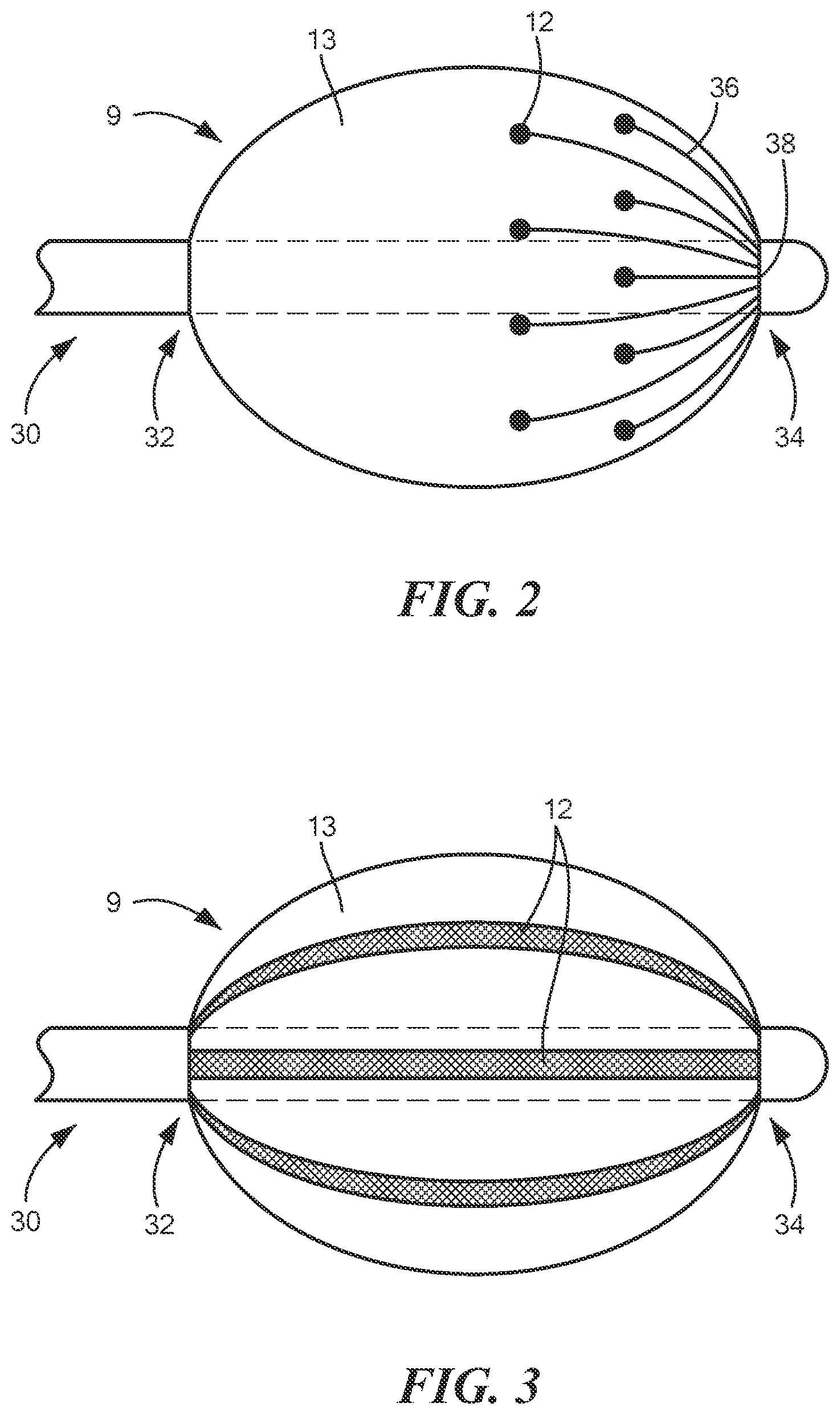 Patent US12496124 Figure 2 – Method for applying conductors to catheter based balloons