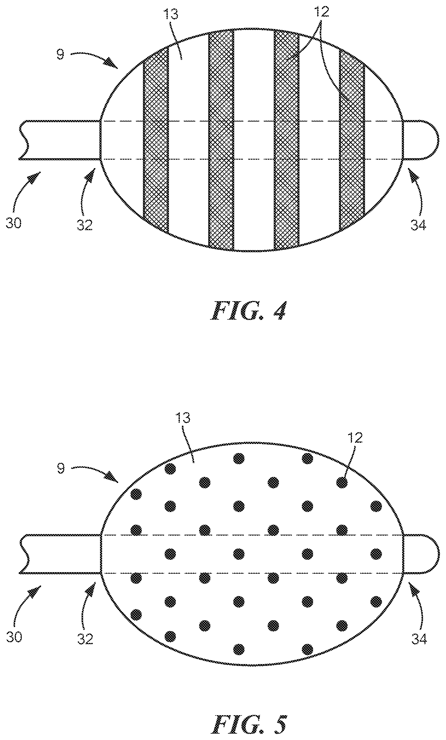 Patent US12496124 Figure 3 – Method for applying conductors to catheter based balloons