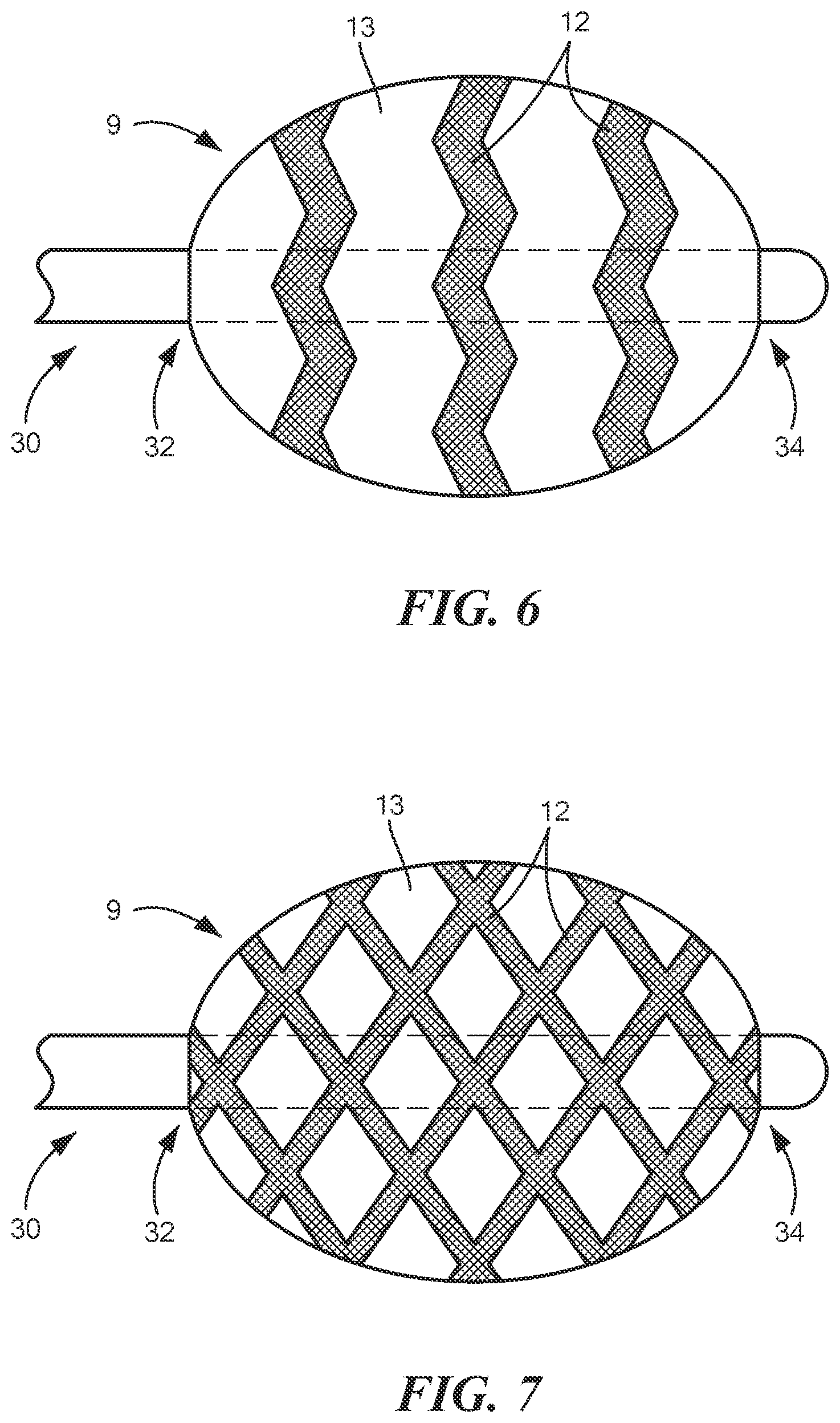 Patent US12496124 Figure 4 – Method for applying conductors to catheter based balloons