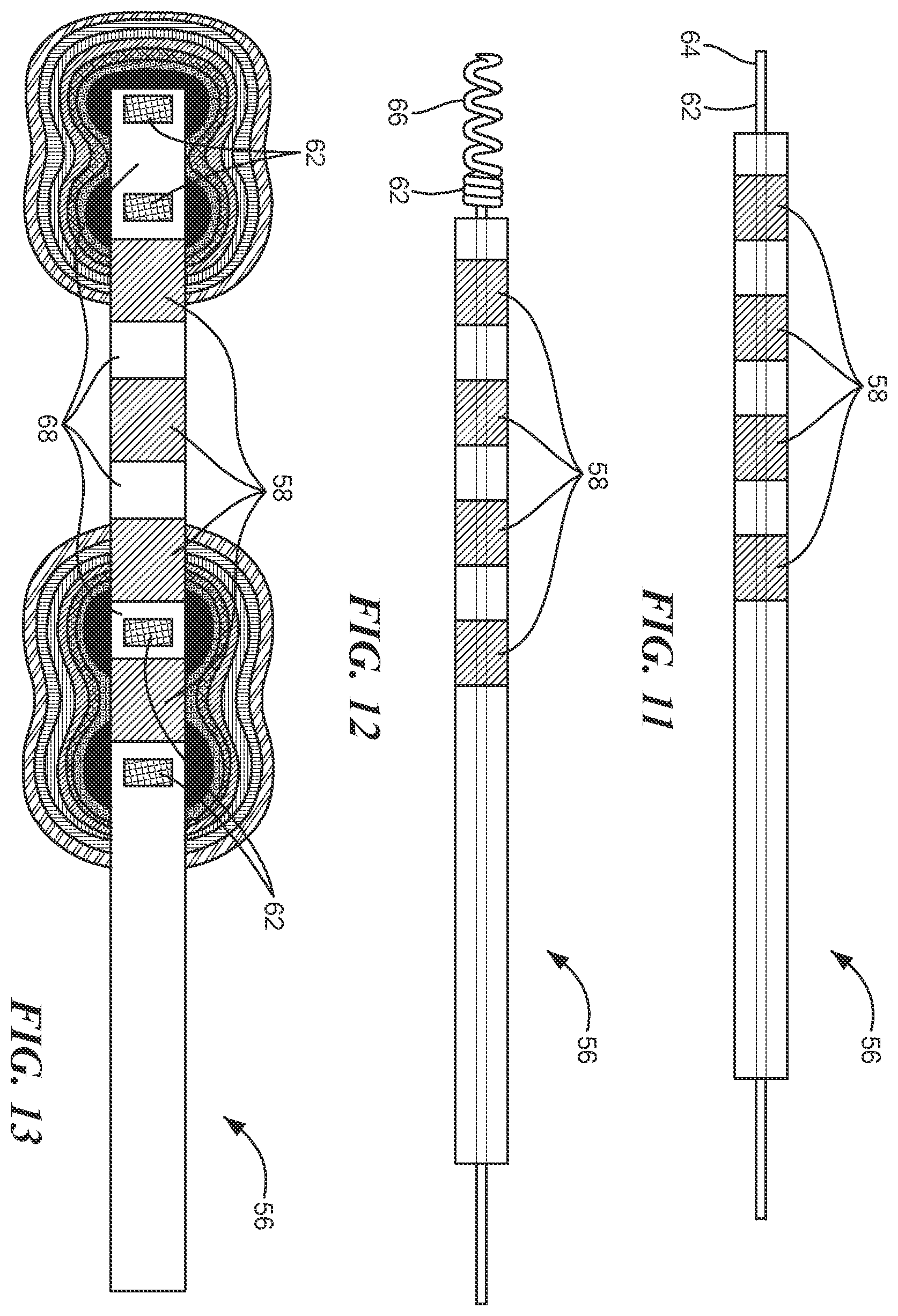 Patent US12496124 Figure 7 – Method for applying conductors to catheter based balloons