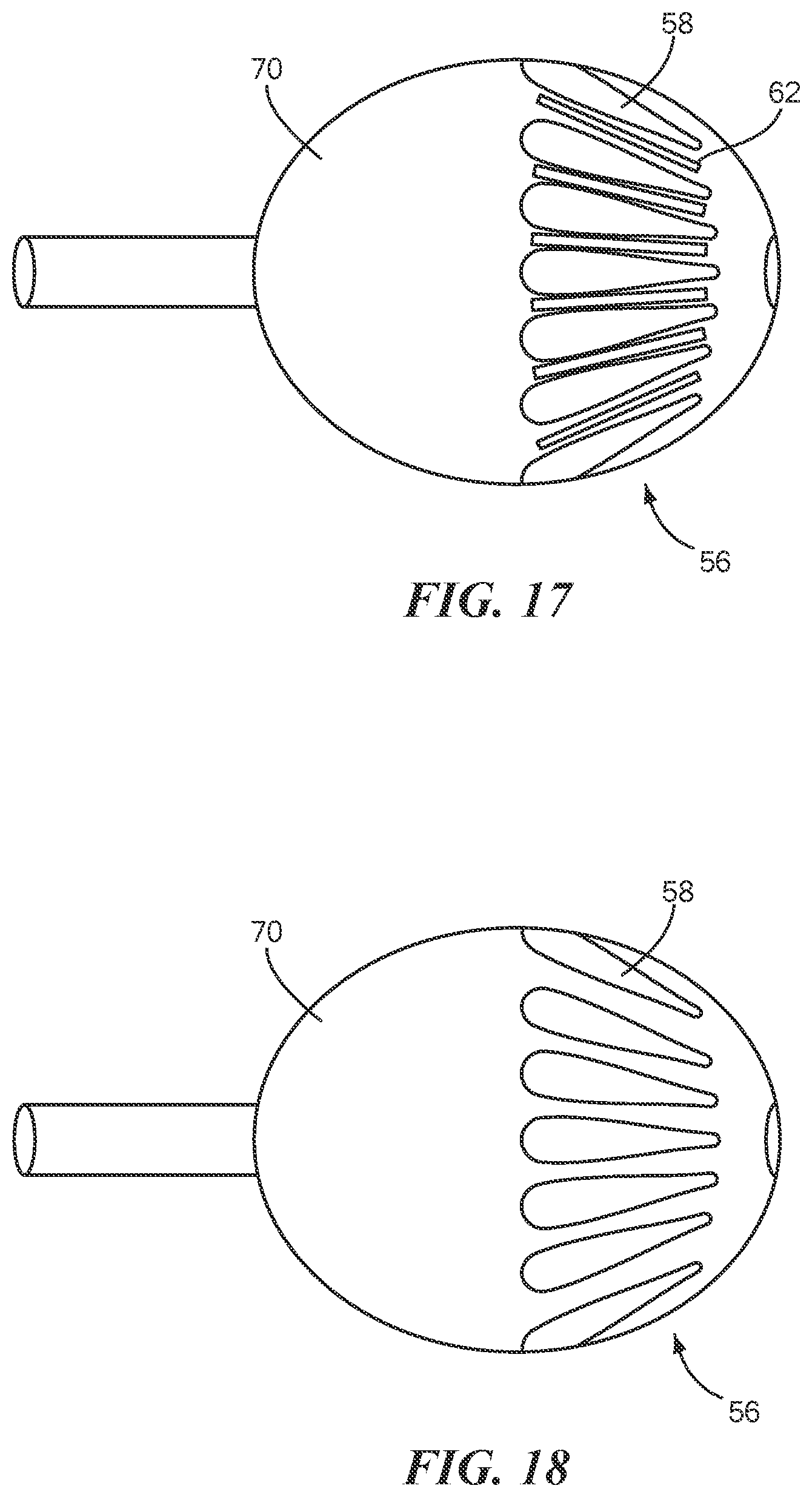 Patent US12496124 Figure 9 – Method for applying conductors to catheter based balloons