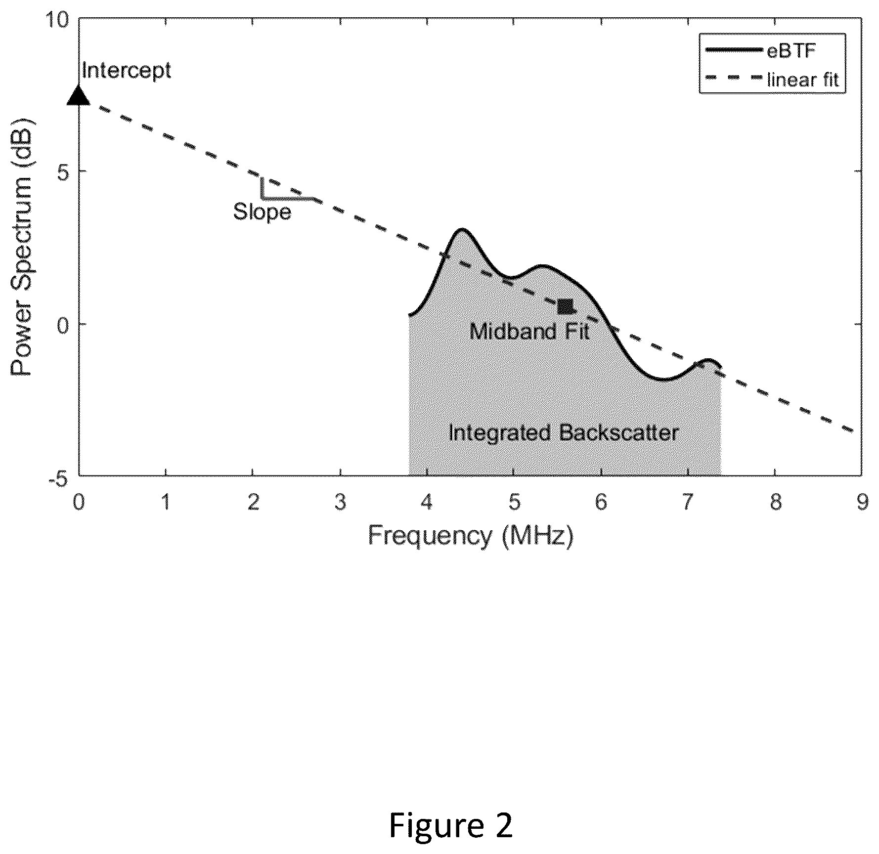 Patent US12496125 Figure 2 – Assessment of atrial myocardial viability using spectral analysis of ultrasound