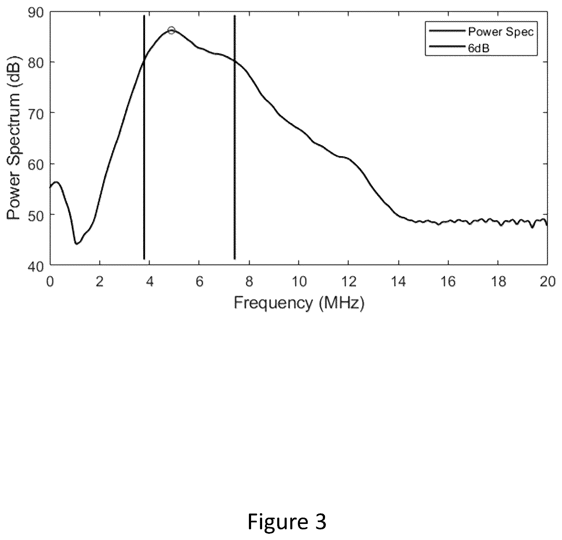 Patent US12496125 Figure 3 – Assessment of atrial myocardial viability using spectral analysis of ultrasound