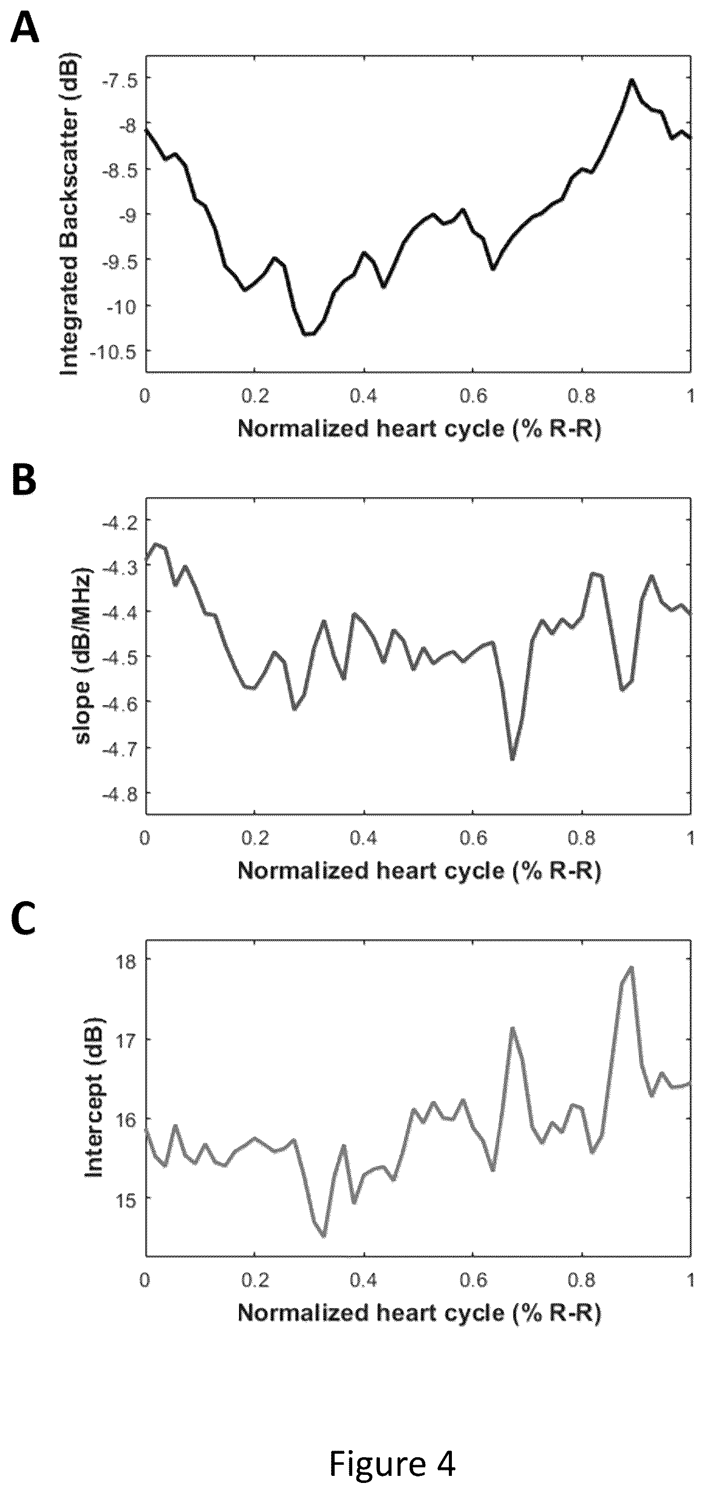 Patent US12496125 Figure 4 – Assessment of atrial myocardial viability using spectral analysis of ultrasound