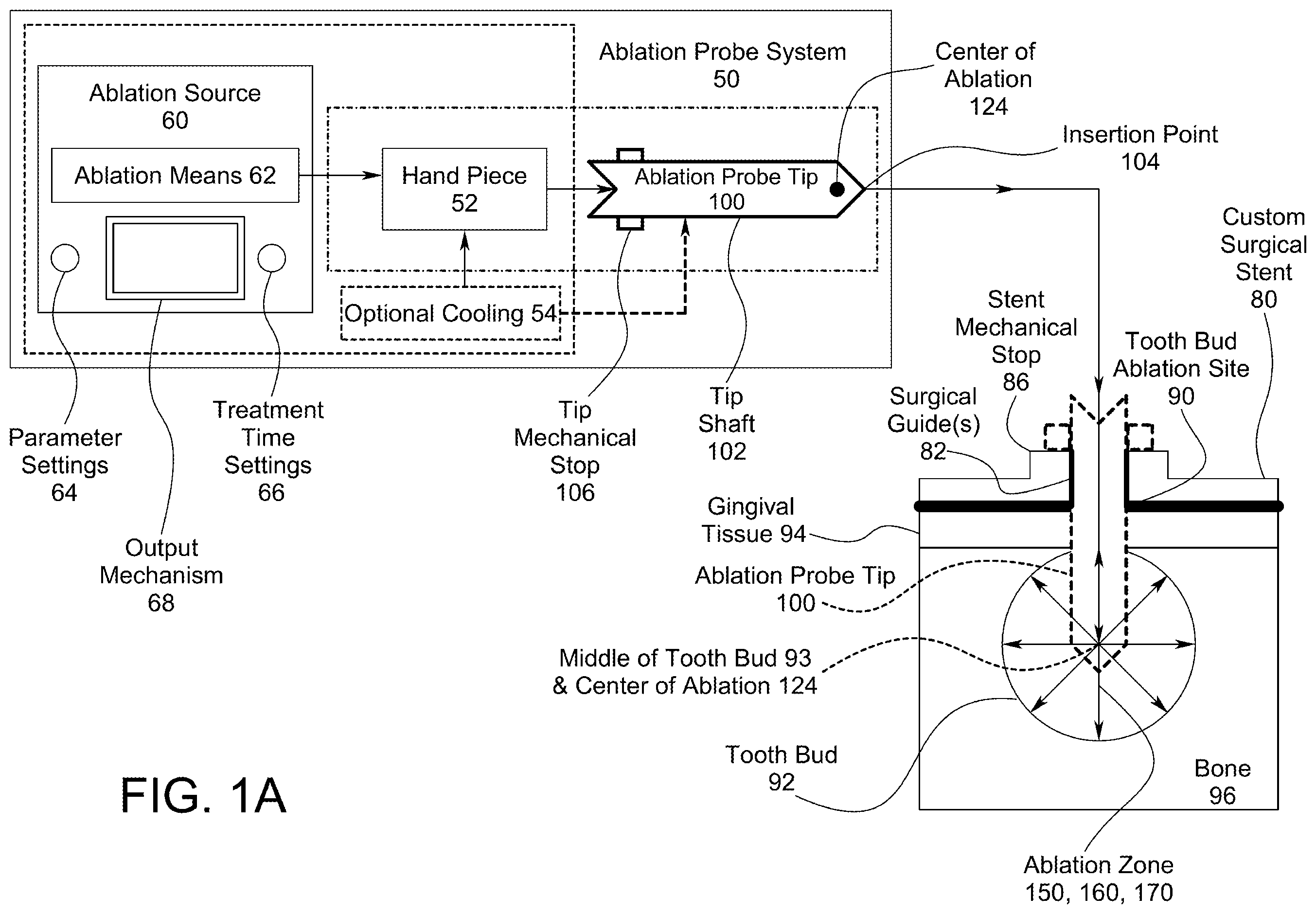 Patent US12496129 Figure 1 – Ablation probe systems