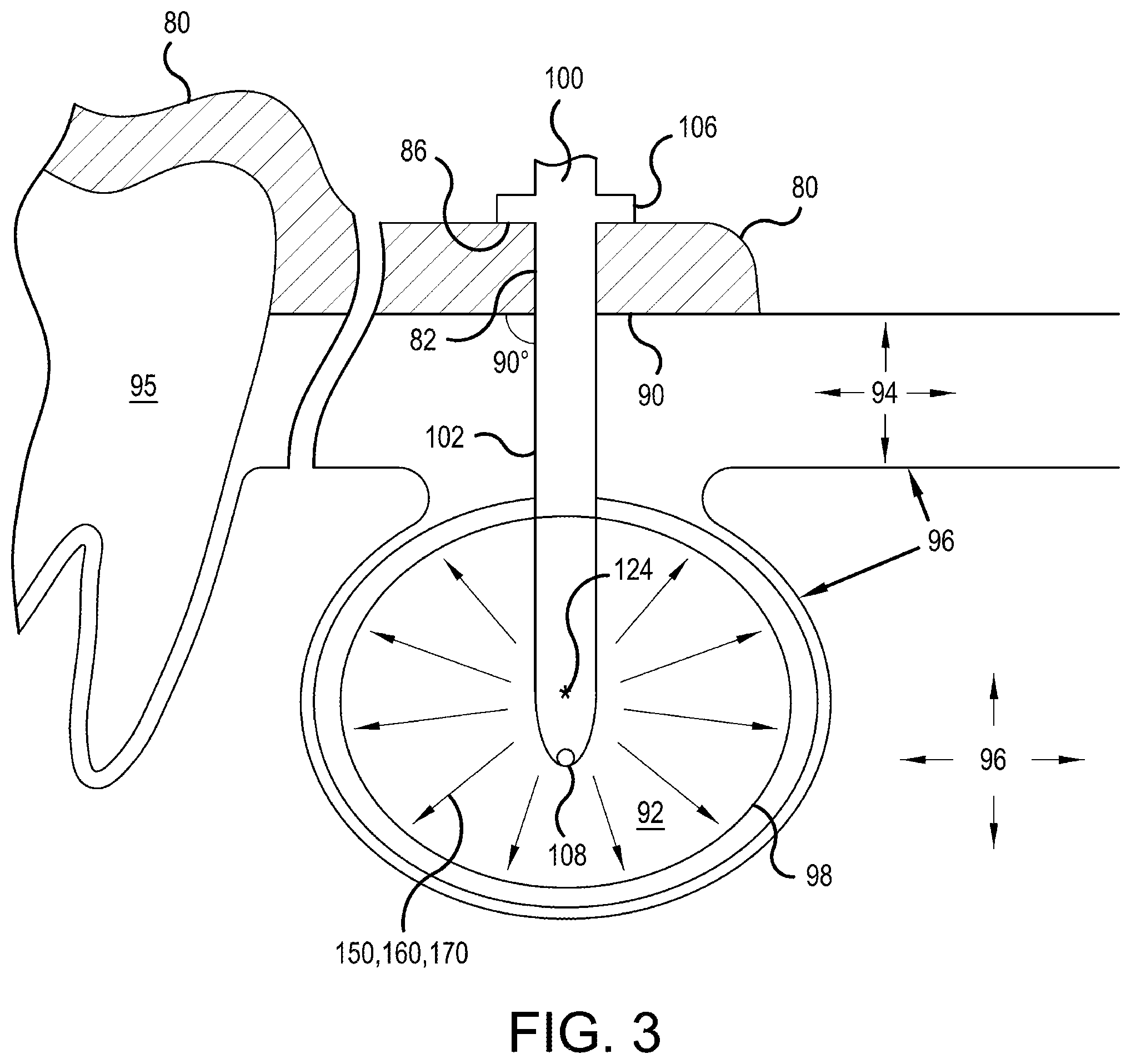 Patent US12496129 Figure 4 – Ablation probe systems