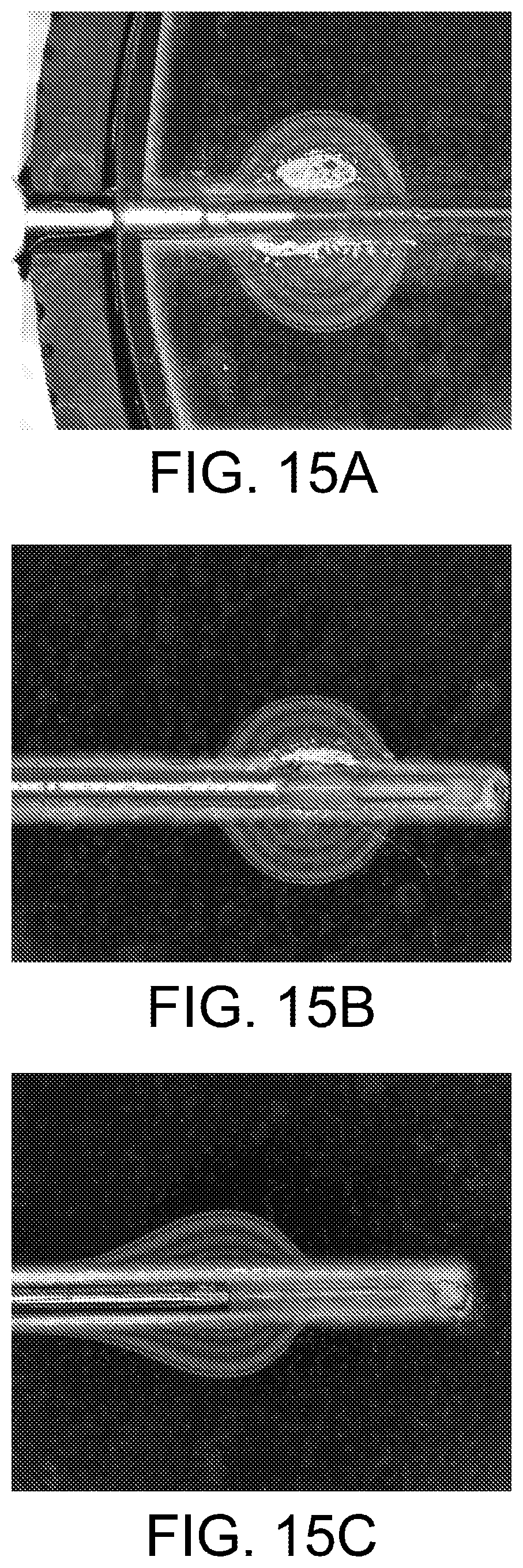 Patent US12496129 Figure 14 – Ablation probe systems