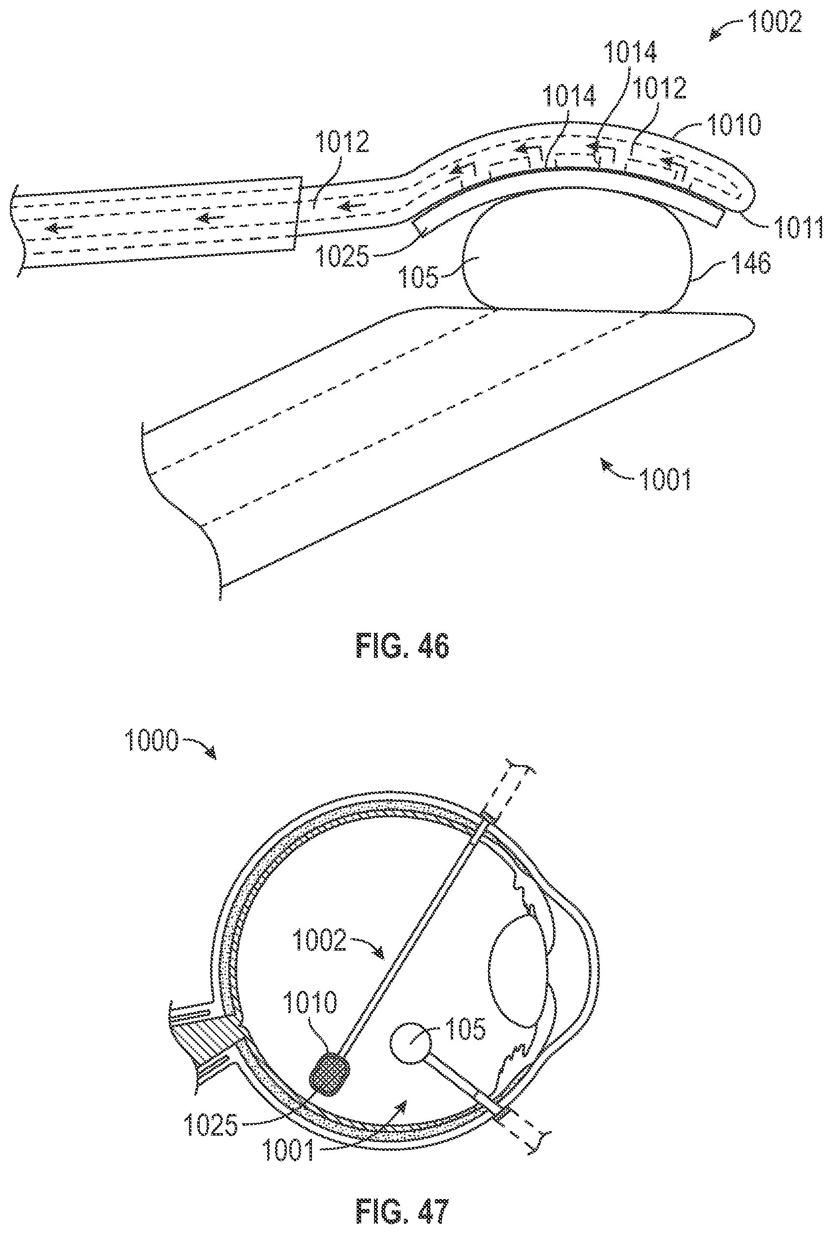 Patent US12496130 Figure 17 – Devices and methods for targeted delivery of a substance